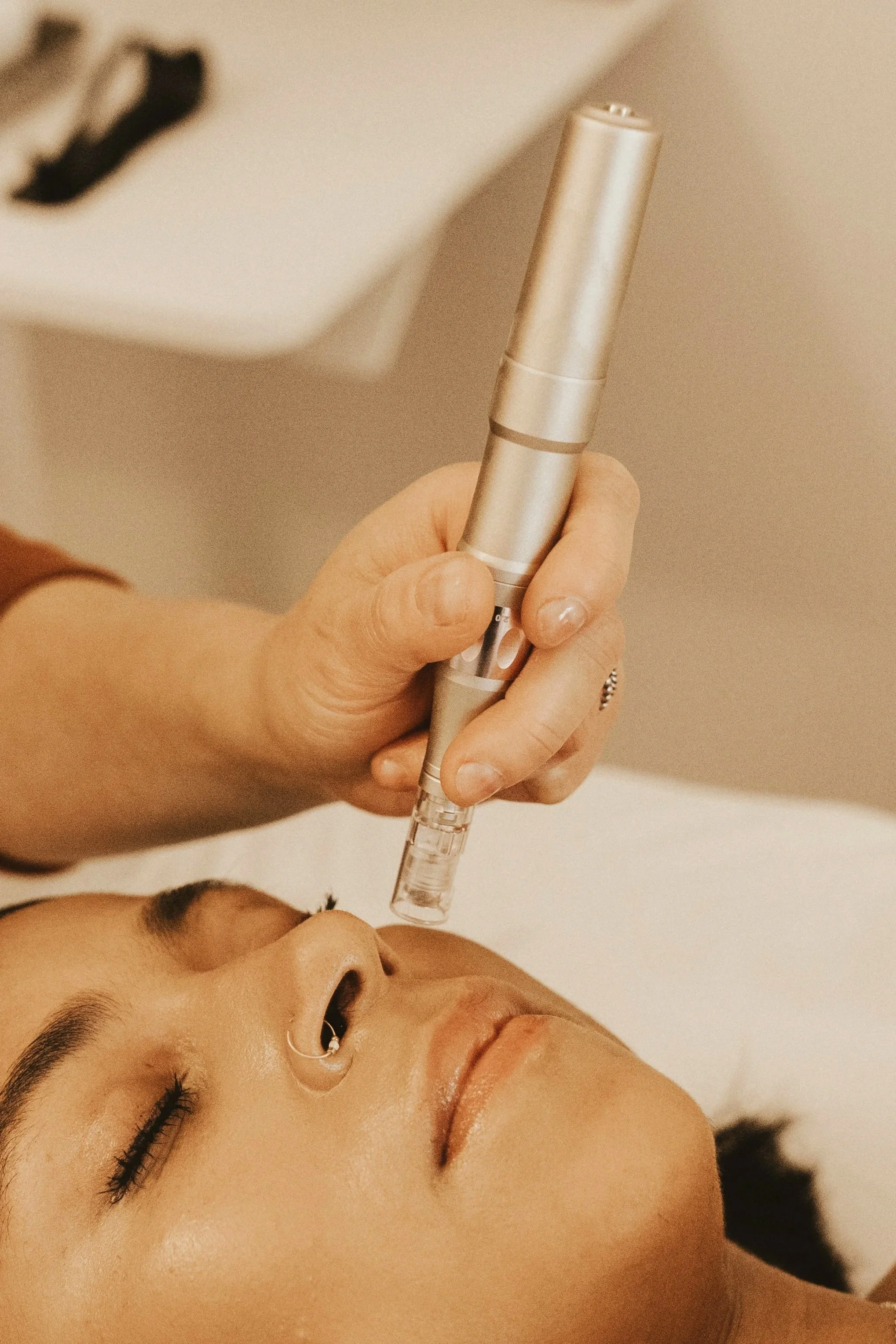 asian woman's face, with practitioner wearing white, performing micro needling on her forehead