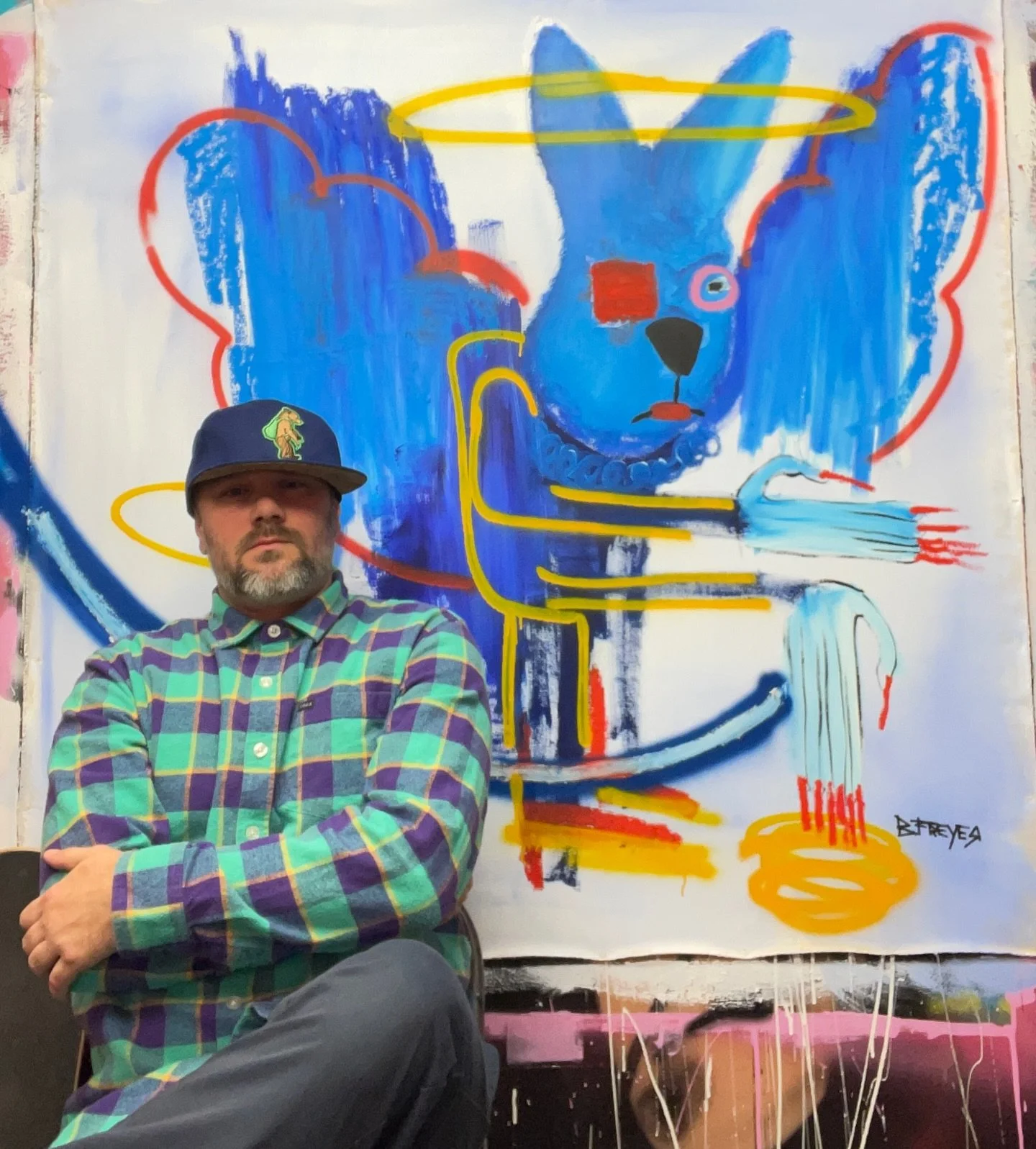 It&rsquo;s been weeks now and I&rsquo;m finally able to use my hand to paint and draw. My injury was 7 breaks and a dislocation, which resulted in not being able to make a fist or bend my pinky. As of today I&rsquo;m almost making a fist, and I can n