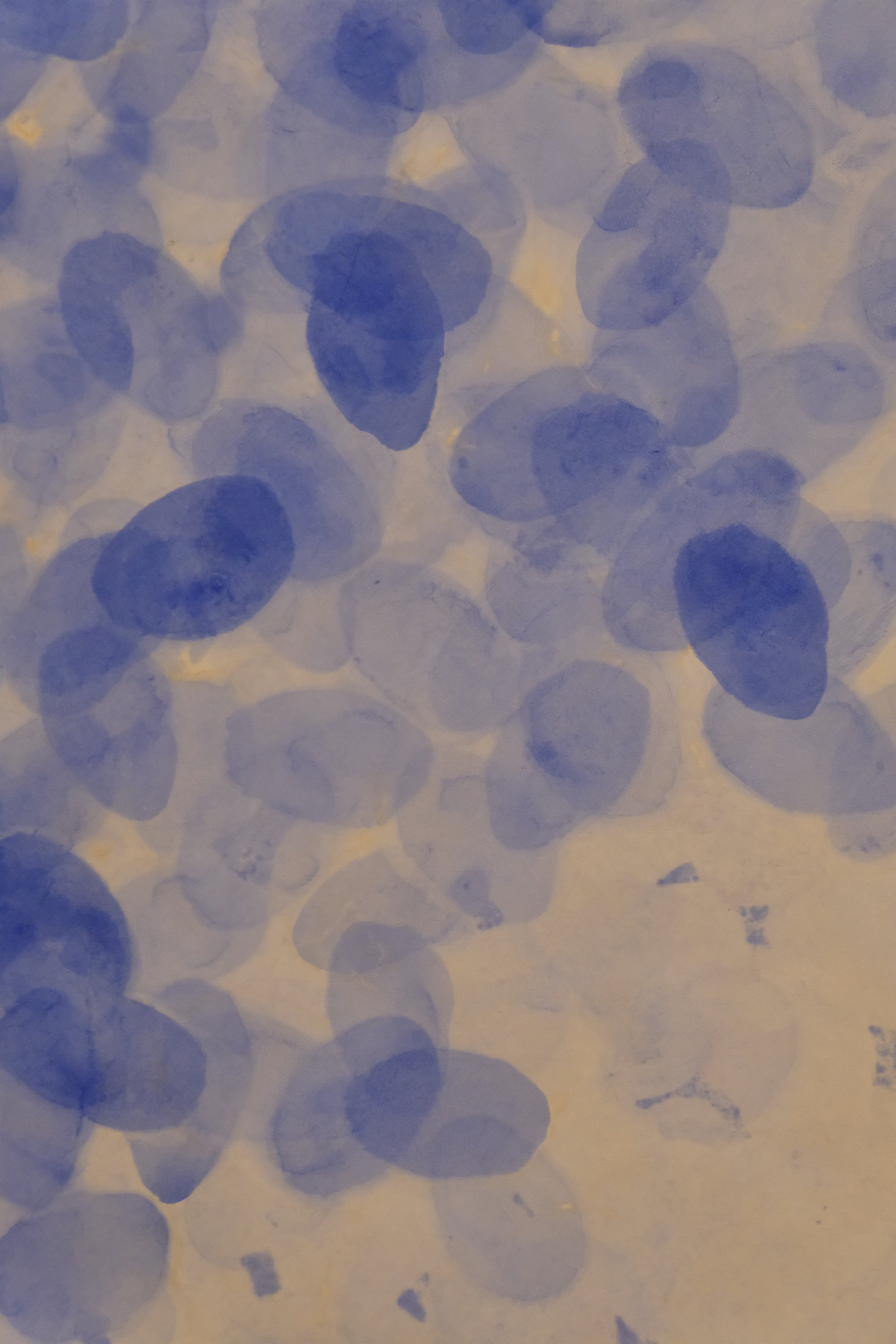  Sam Francis, Detail of  Blue Balls  (1962). The Doris and Donald Fisher Collection at the SFMOMA. Photography © The Noun. 