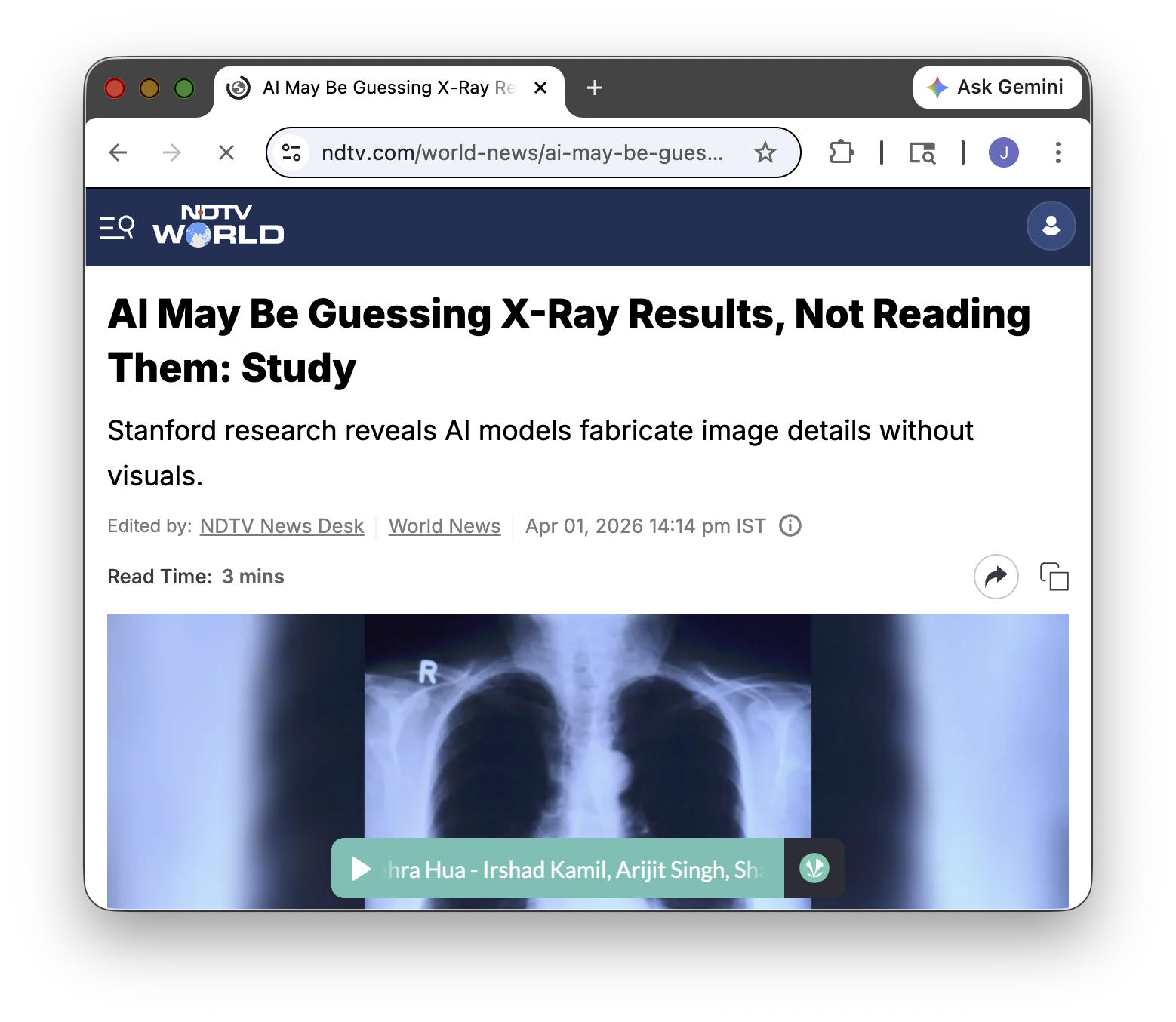 Signals: Was the Diagnosis Already in the Chart?