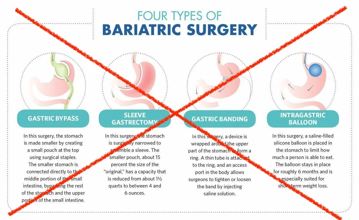 Notes: GLP-1s Cut Bariatric Surgery 34%