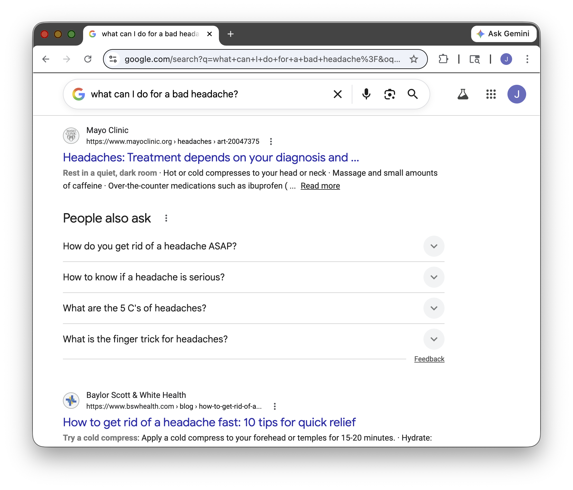 google search for headache remedy