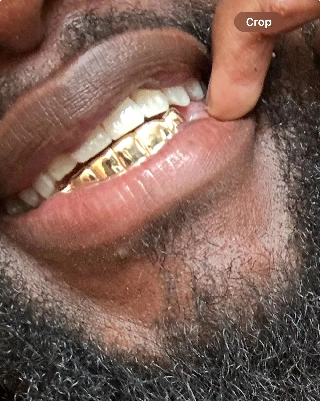 Close-up of a person with gold dental grillz on their teeth, smiling, with a finger pulling down their lip to expose the grillz on the south side of Chicago.