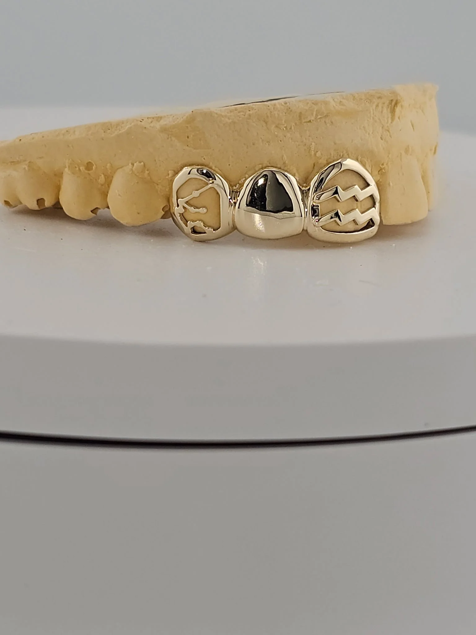 How Much Do Custom Grillz Cost in Chicago? Pricing, Process &amp; What to Expect