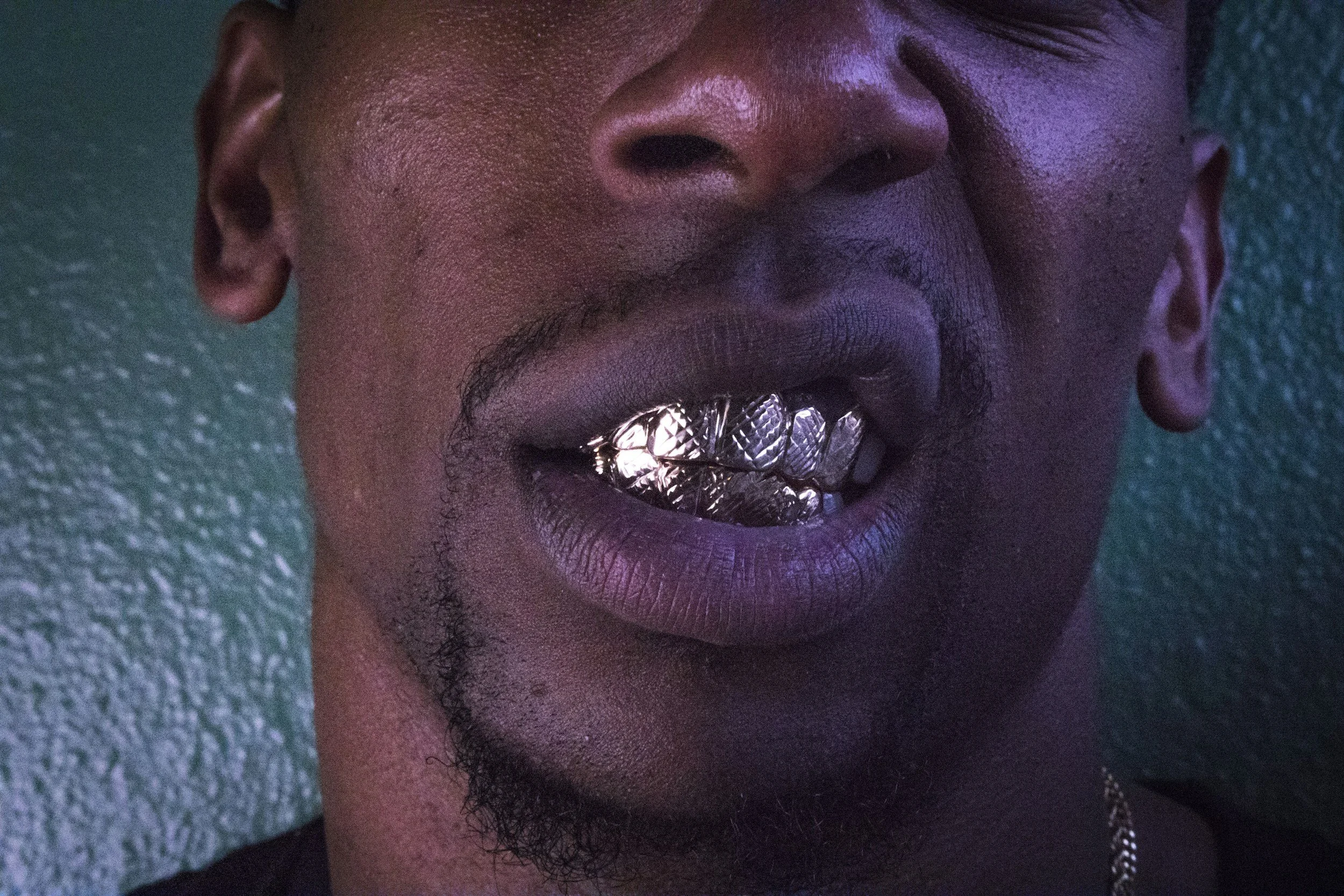 Close-up of a person's face showing their mouth with gold grillz on their teeth.