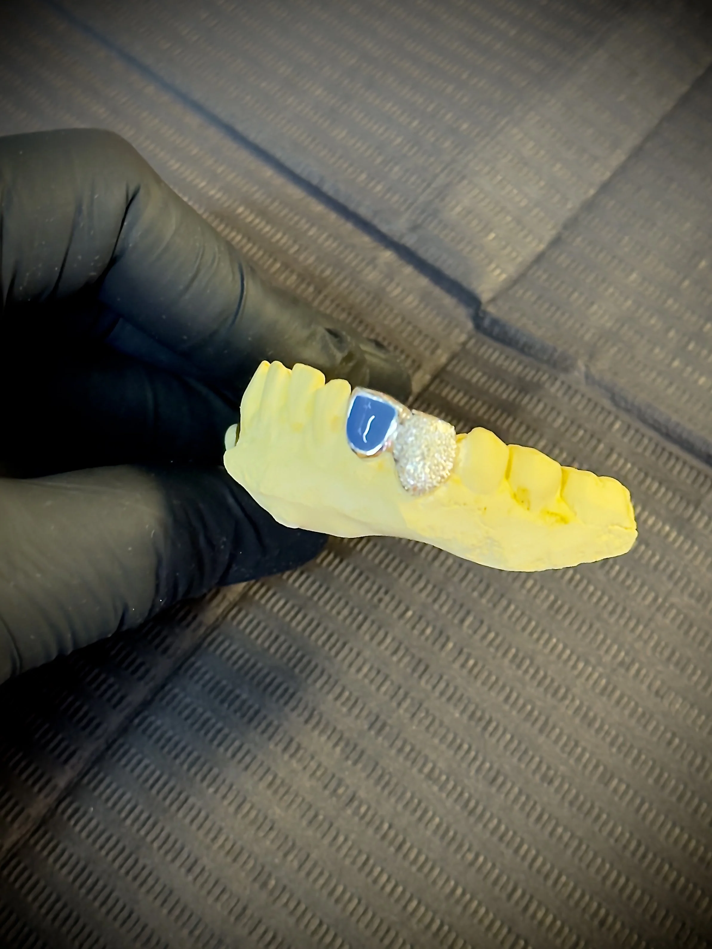 One-Day Grillz: Pros, Cons, and Why Jem Junkies Doesn’t Offer Same-Day Grillz in Chicago