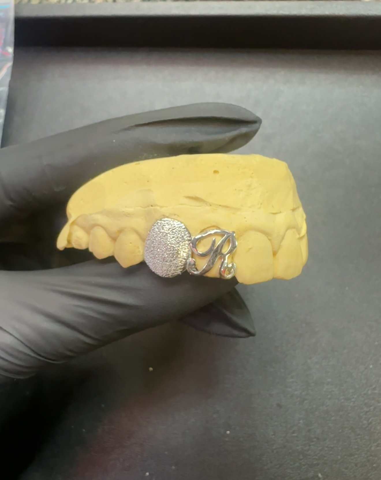 A yellow dental mold or model with a silver decorative letter 'R' charm attached, held by a person wearing a black glove.