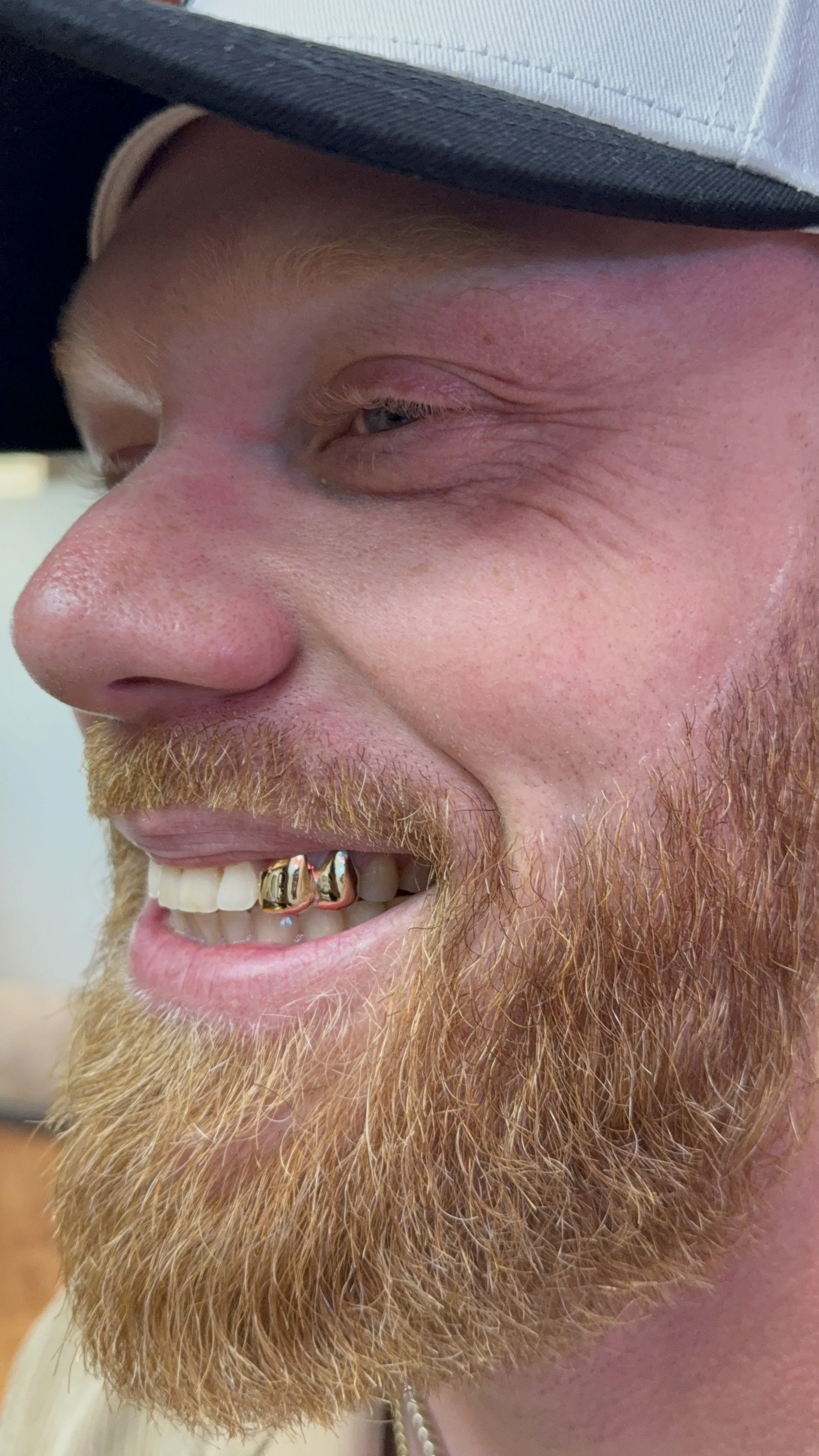 2pc 10k gold grillz Chicago