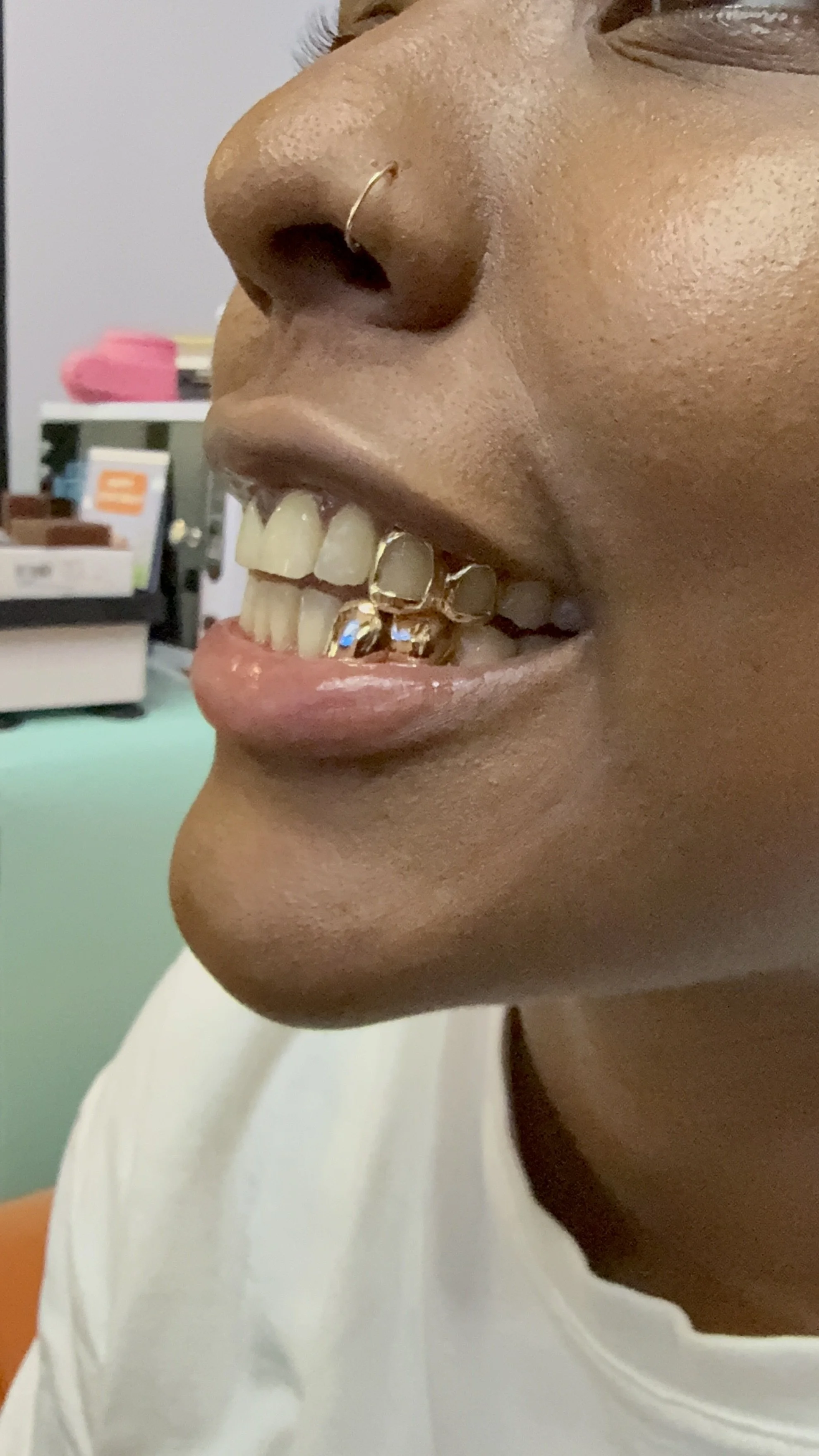 14k Gold Grillz 2 pc top and bottom Chicago