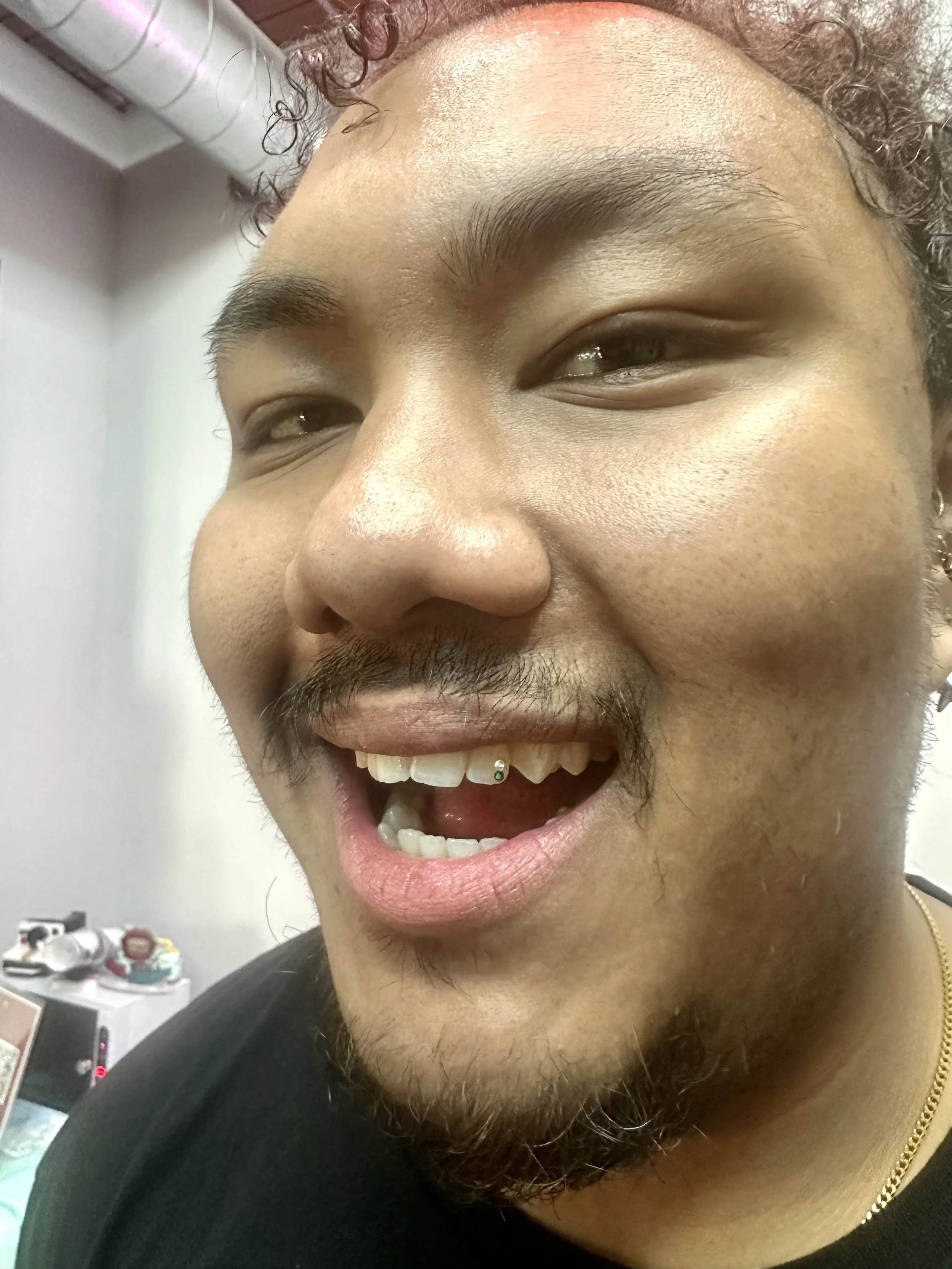 small multi-colored tooth gems in chicago