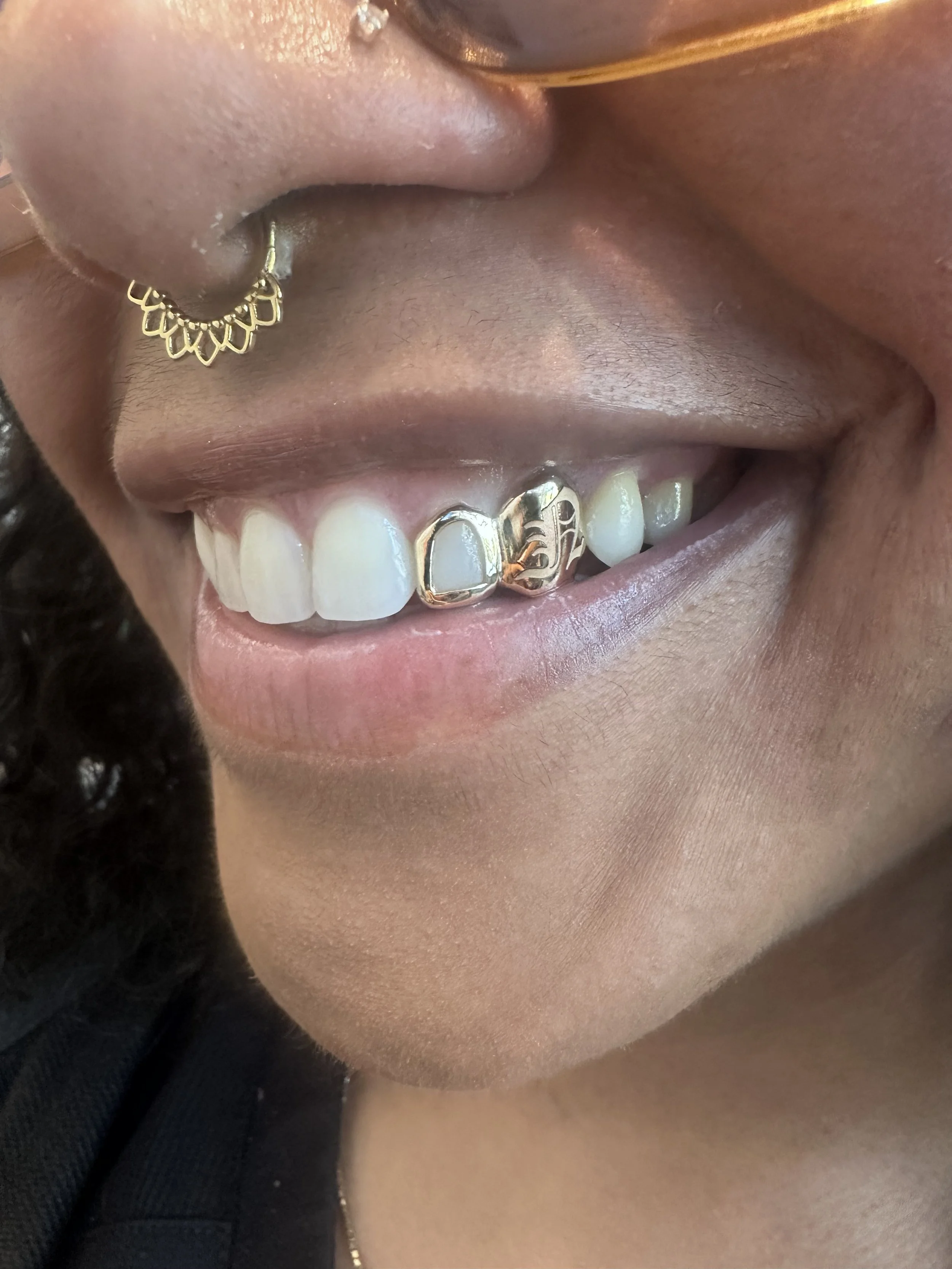 laser 2pc 10k grillz