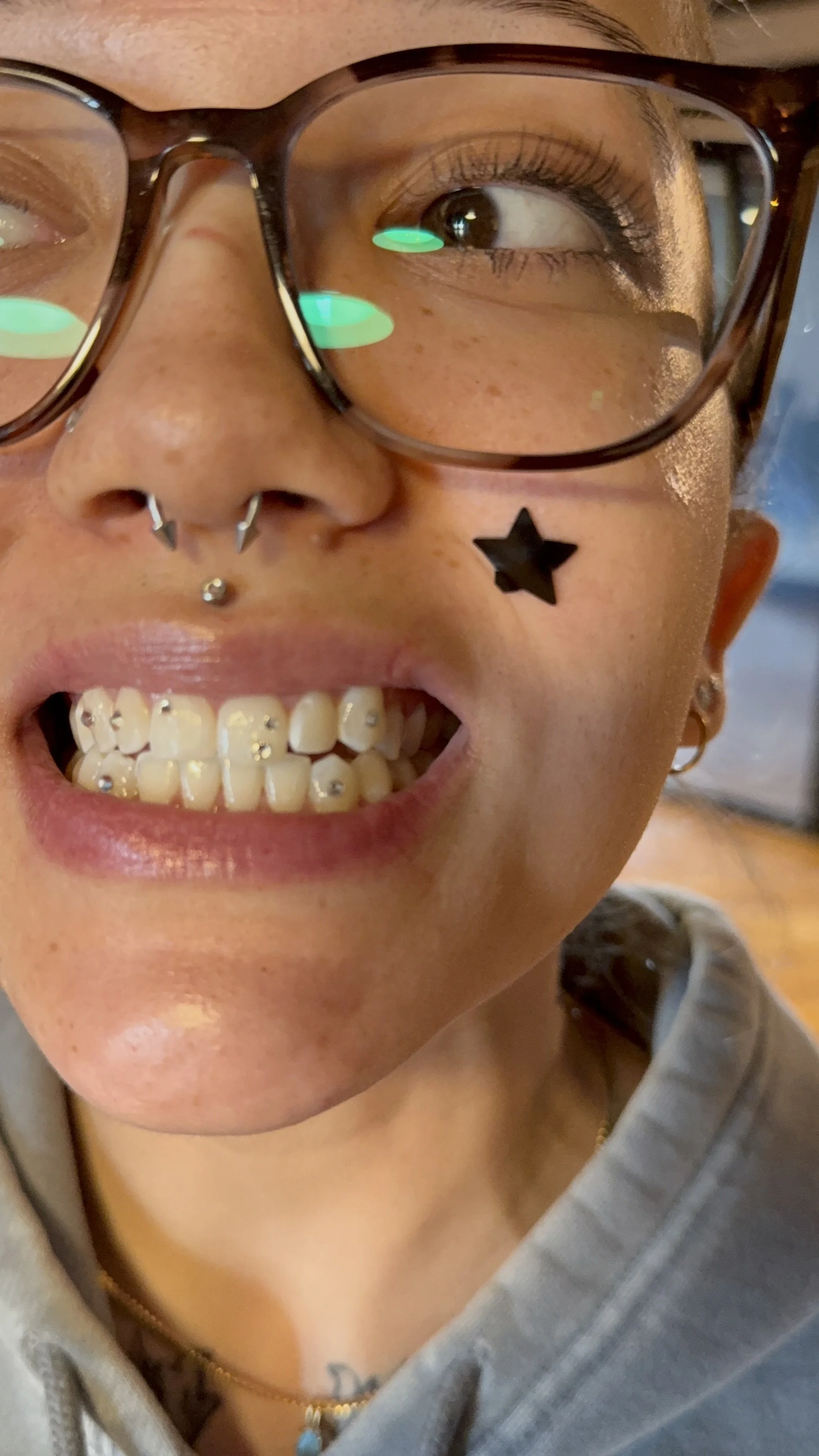 Freestyle tooth gems chicago