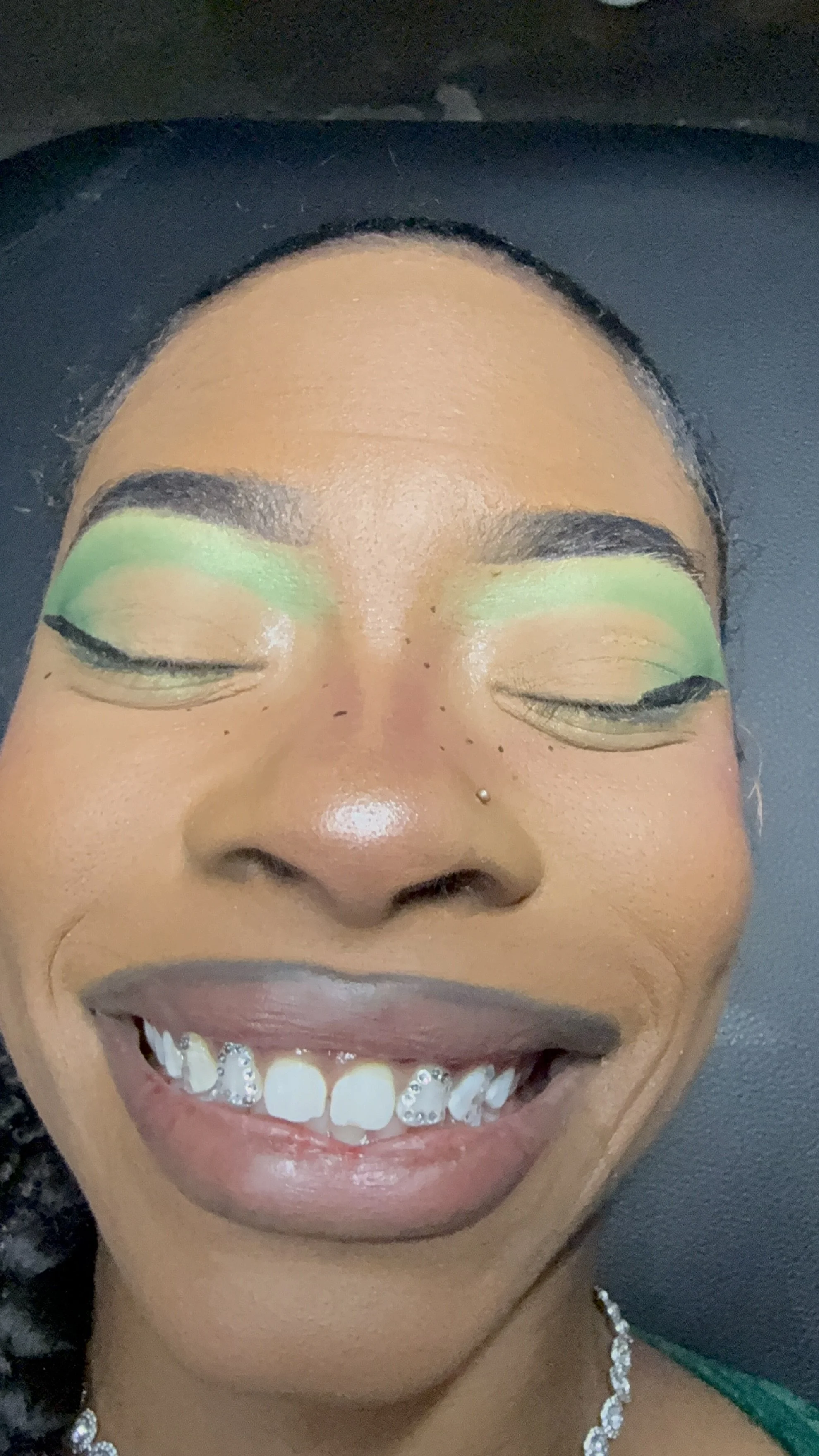 Double Window tooth gems in Chicago