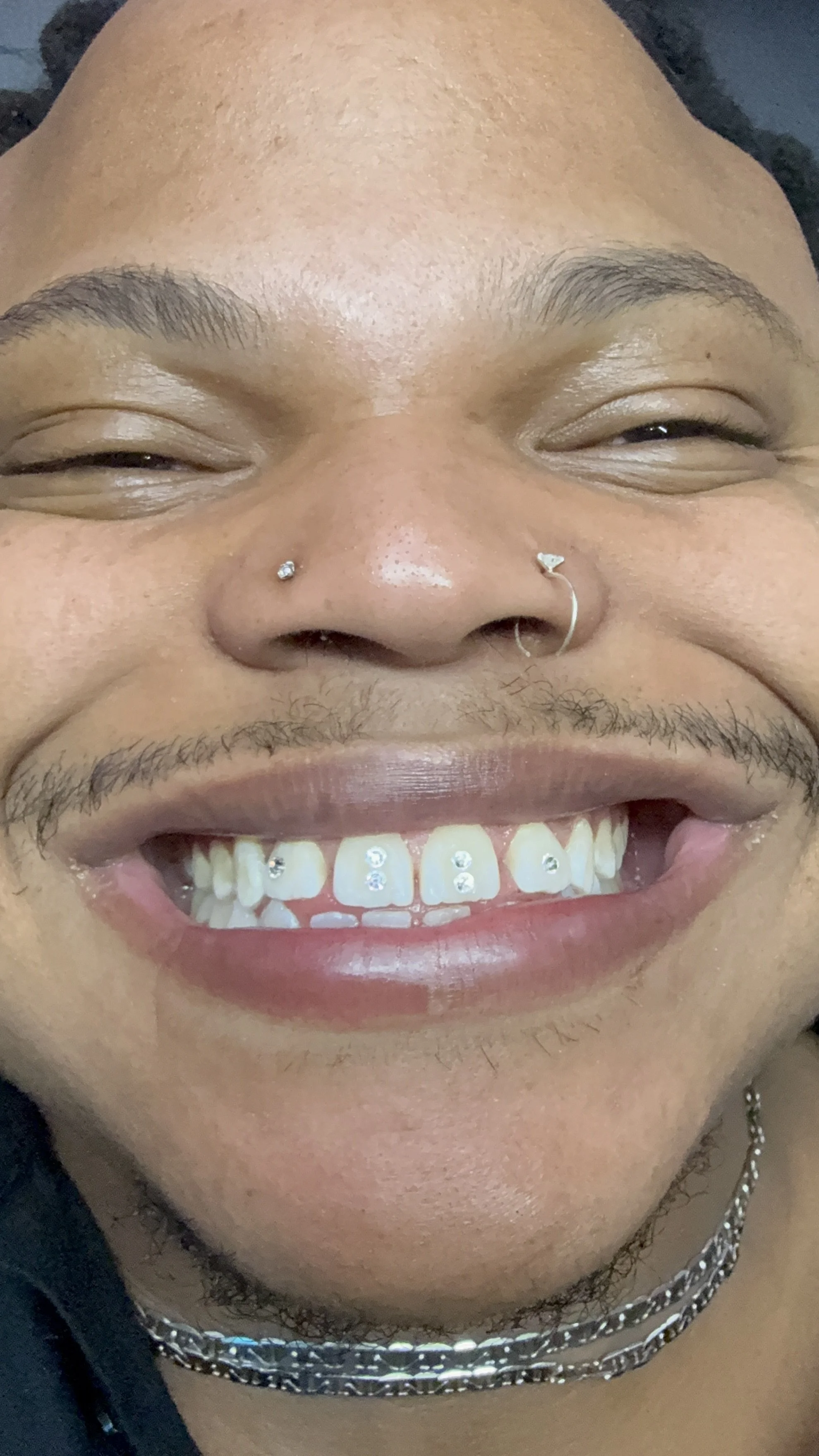 Large Double Tooth Gems