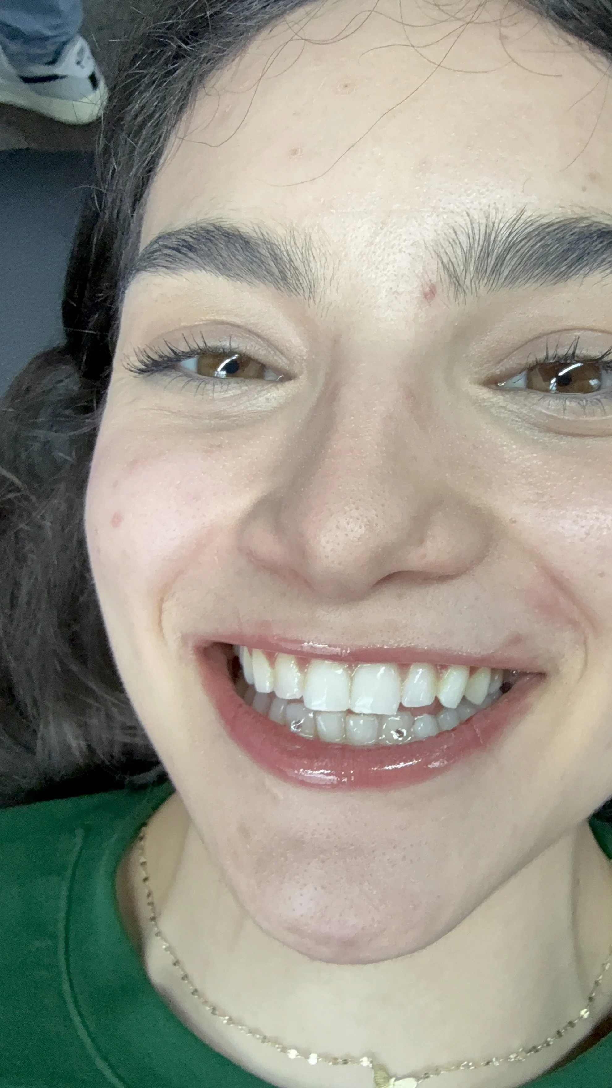 double single bottom tooth gems in chicago