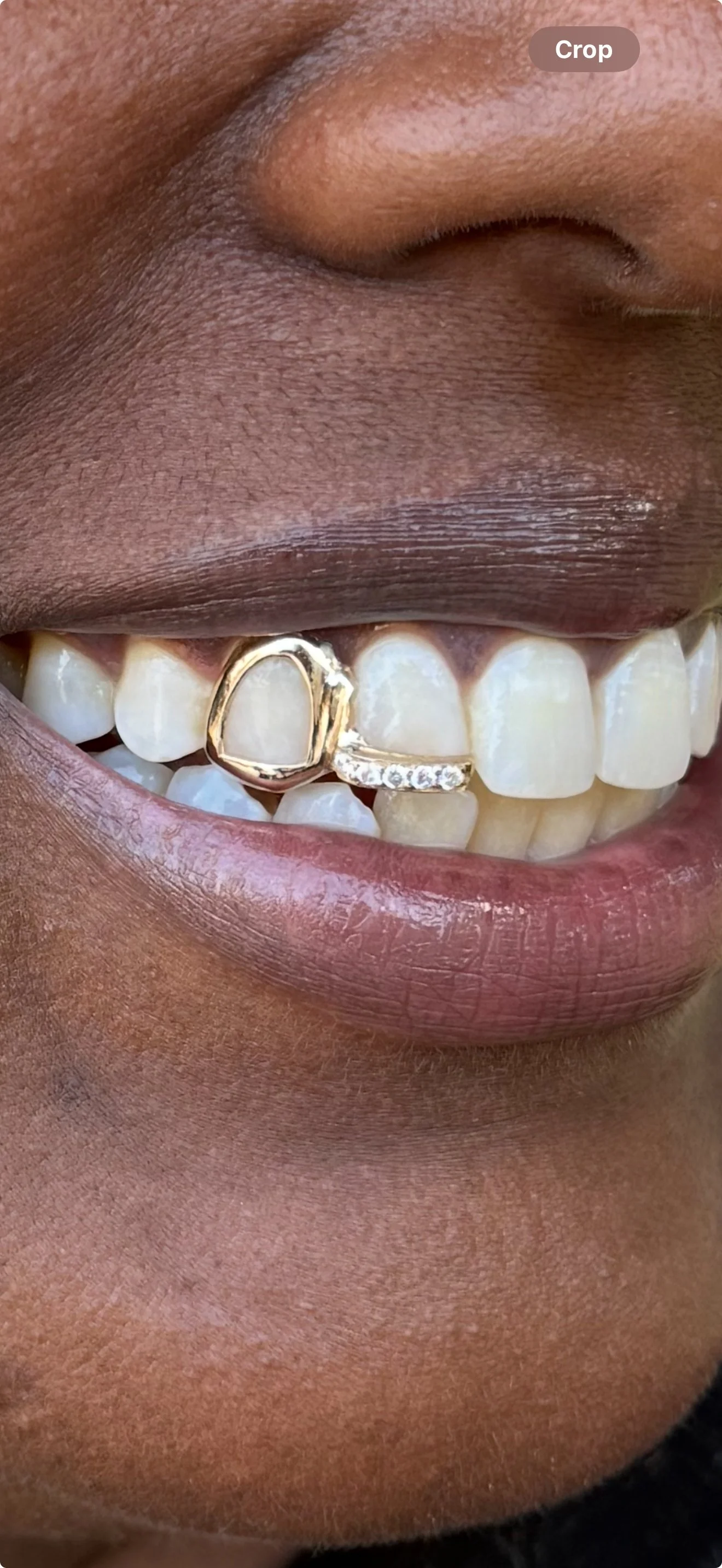 A close-up of a person's smile showing teeth with a gold and diamond dental piece. The person's lips are slightly parted on the south side of Chicago.
