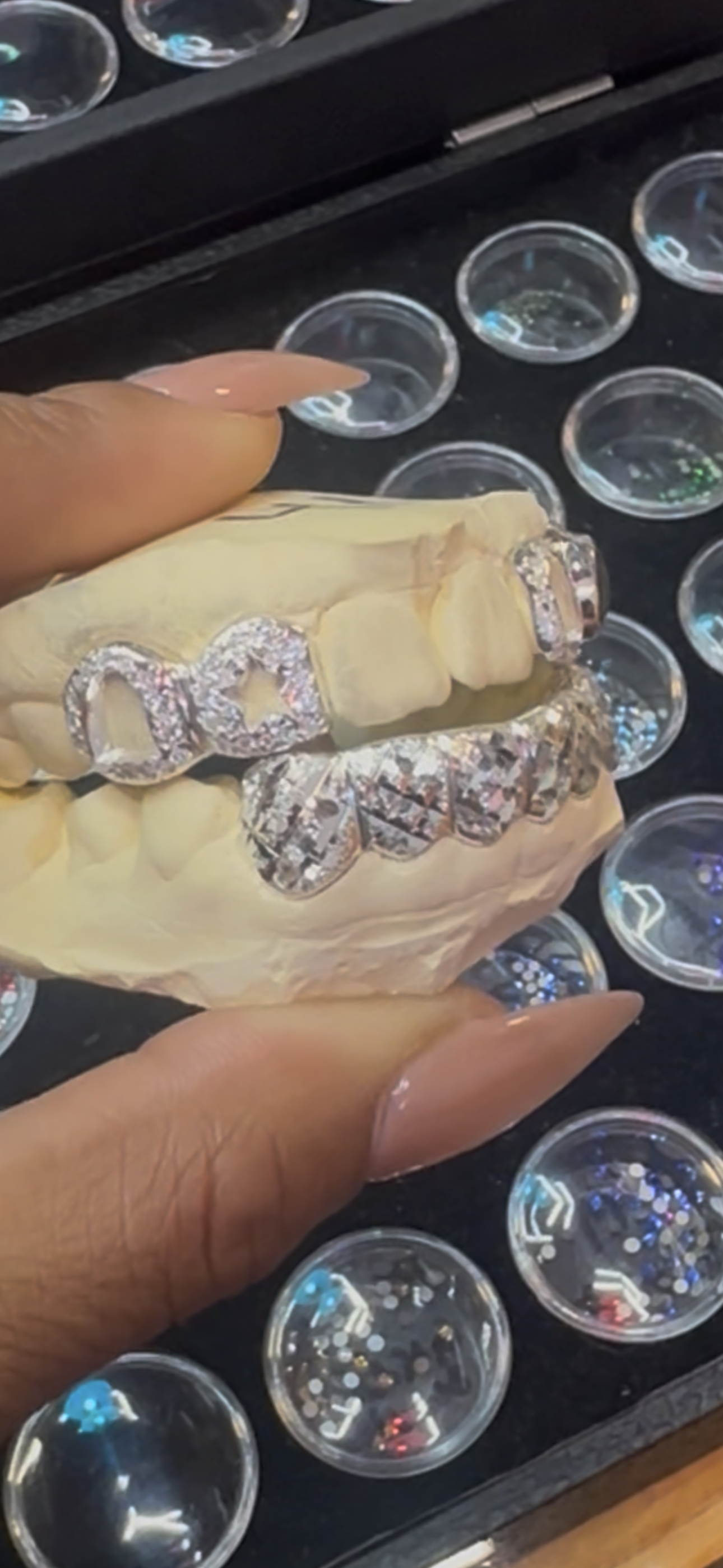 Silver grillz with cut outs and diamond cuts Chicago