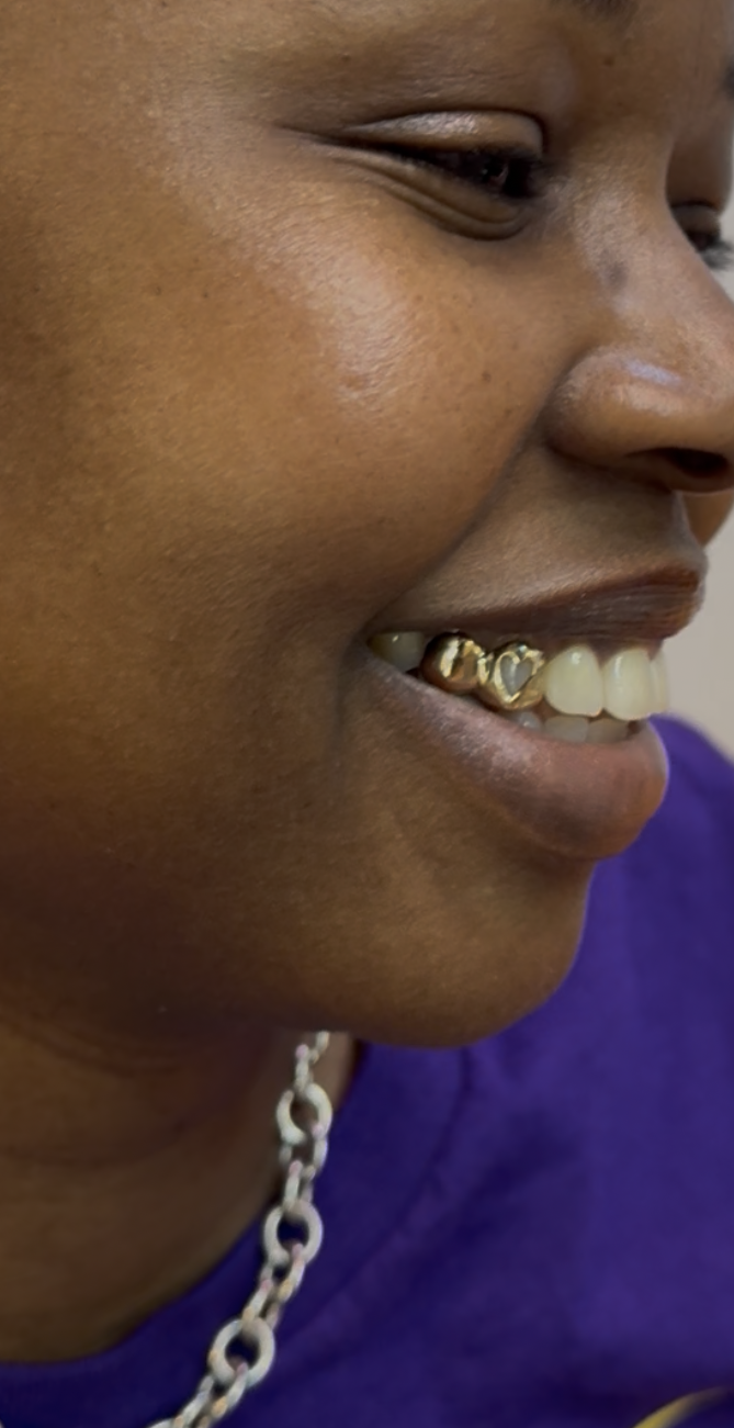 2pc 10k gold grillz chicago