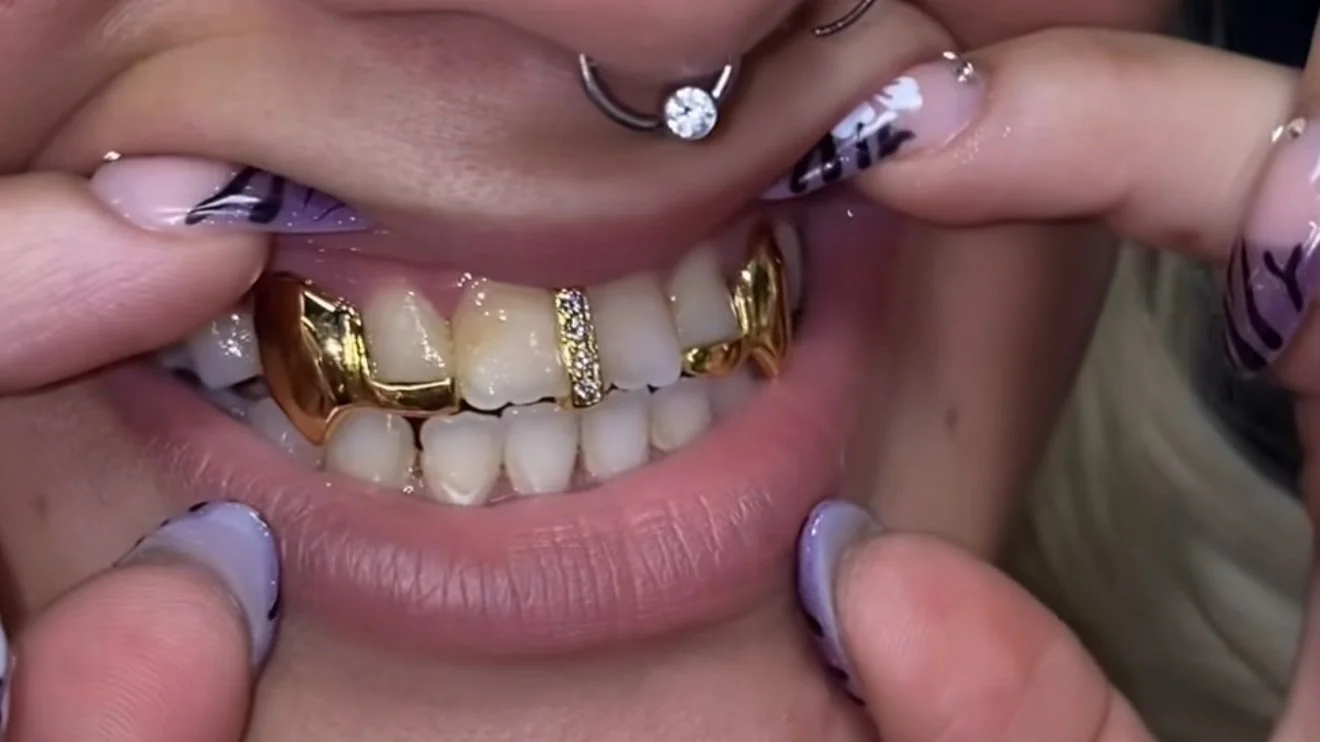 2pc 10k Grillz x 2pc tip plus extended fang, moissanite gap