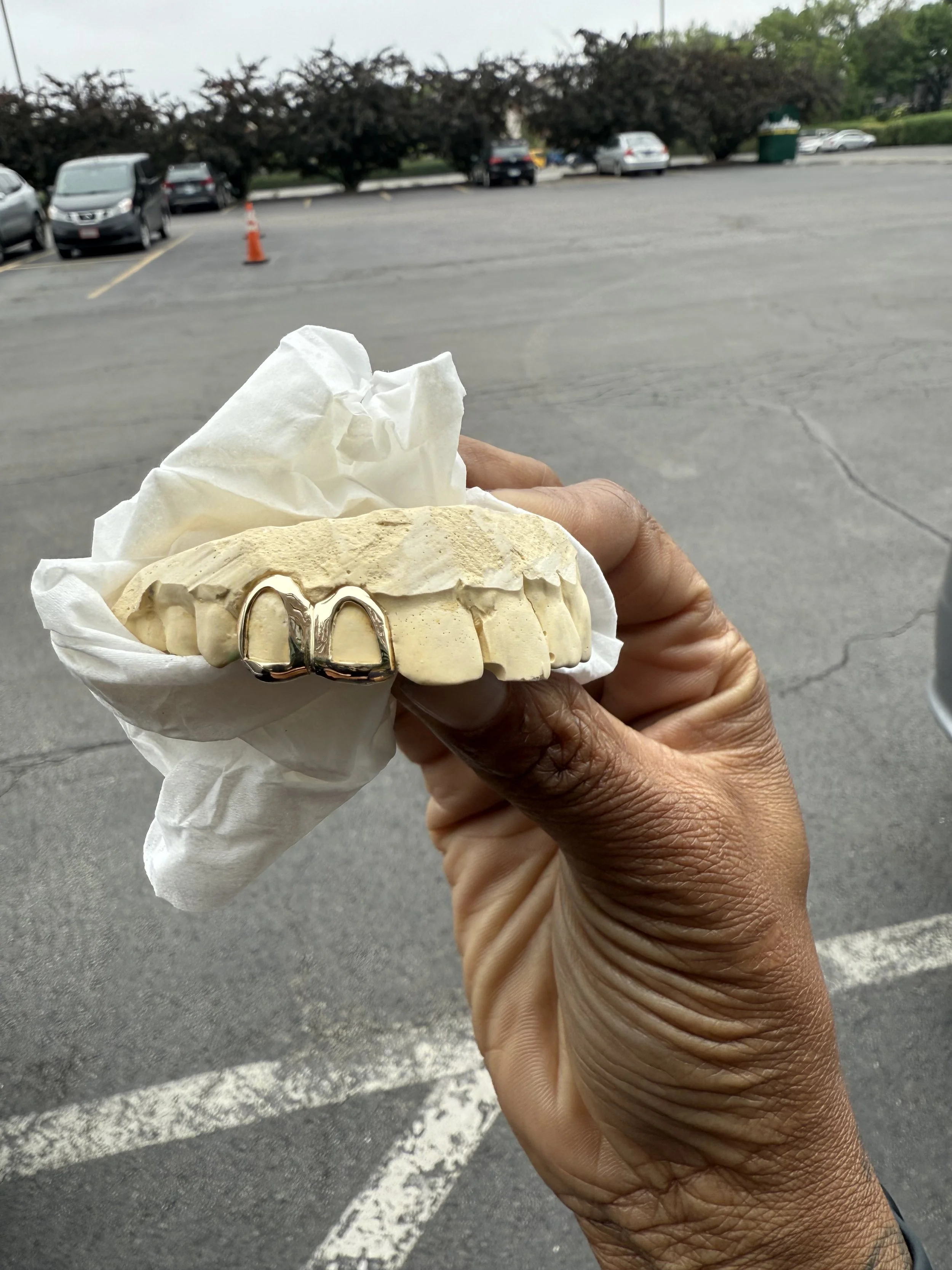 A person holding a dental mold or model with a shiny metal dental crown or prosthetic tooth, wrapped in tissue paper, in a parking lot with cars and trees in the background on the south side of Chicago.