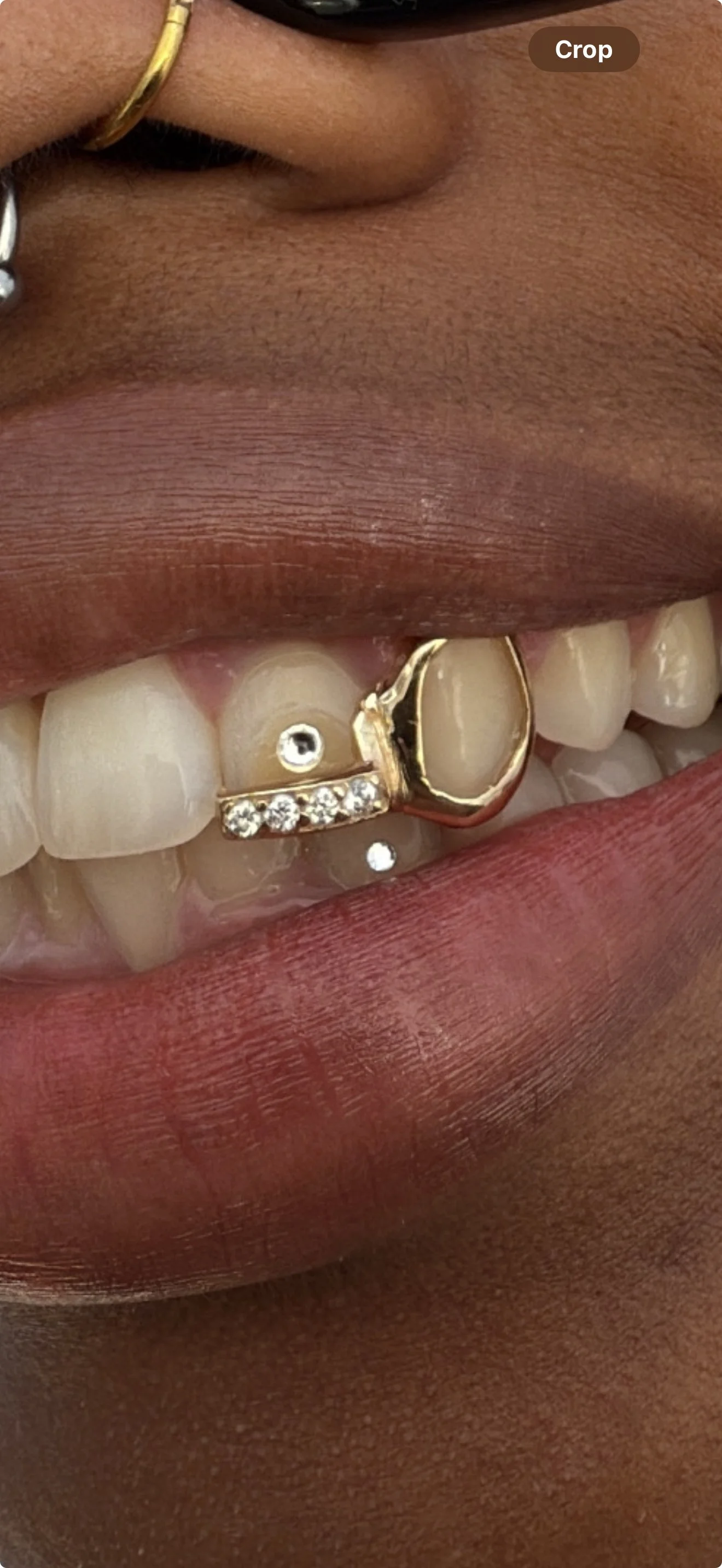 Close-up of a person's mouth showing teeth with gold and diamond dental jewelry on the upper front teeth on the south side of Chicago.