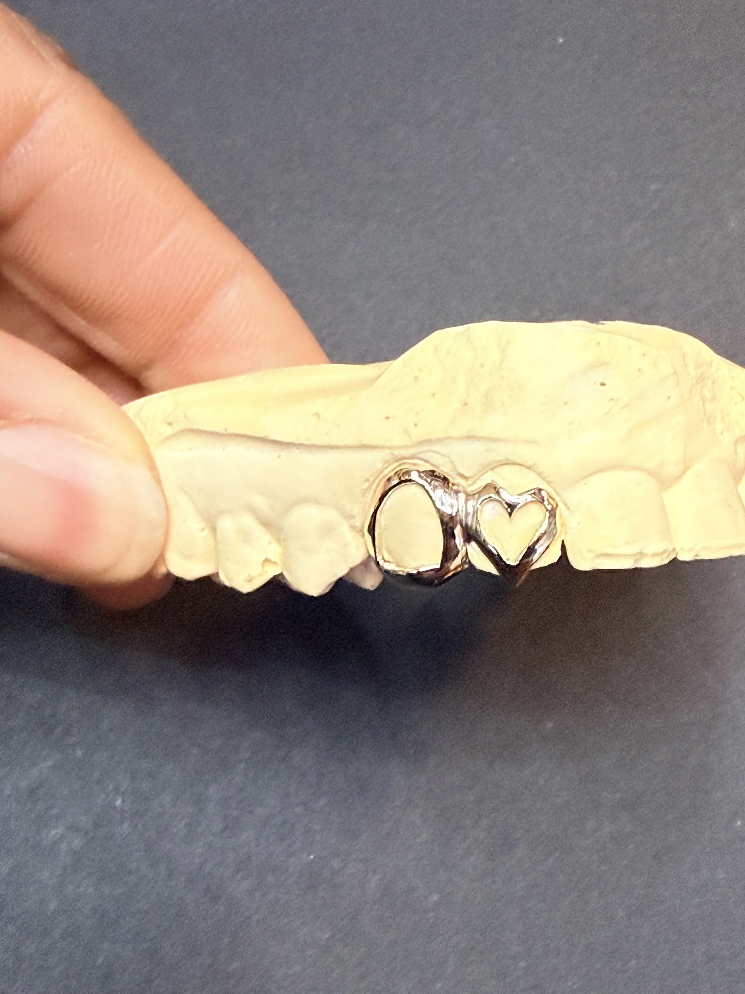 2pc 10k  gold grillz in Chicago