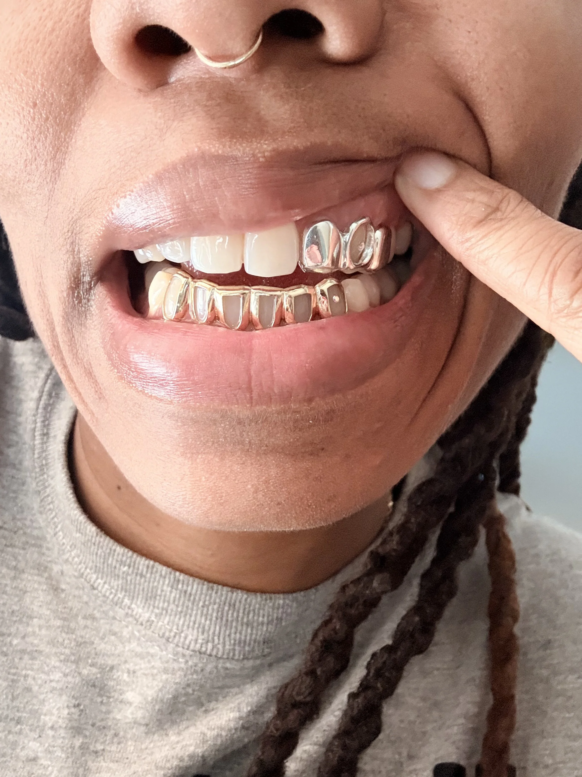 Close-up of a person with a nose ring, showing front teeth with clear and silver grillz, smiling and pointing to a tooth with their finger.