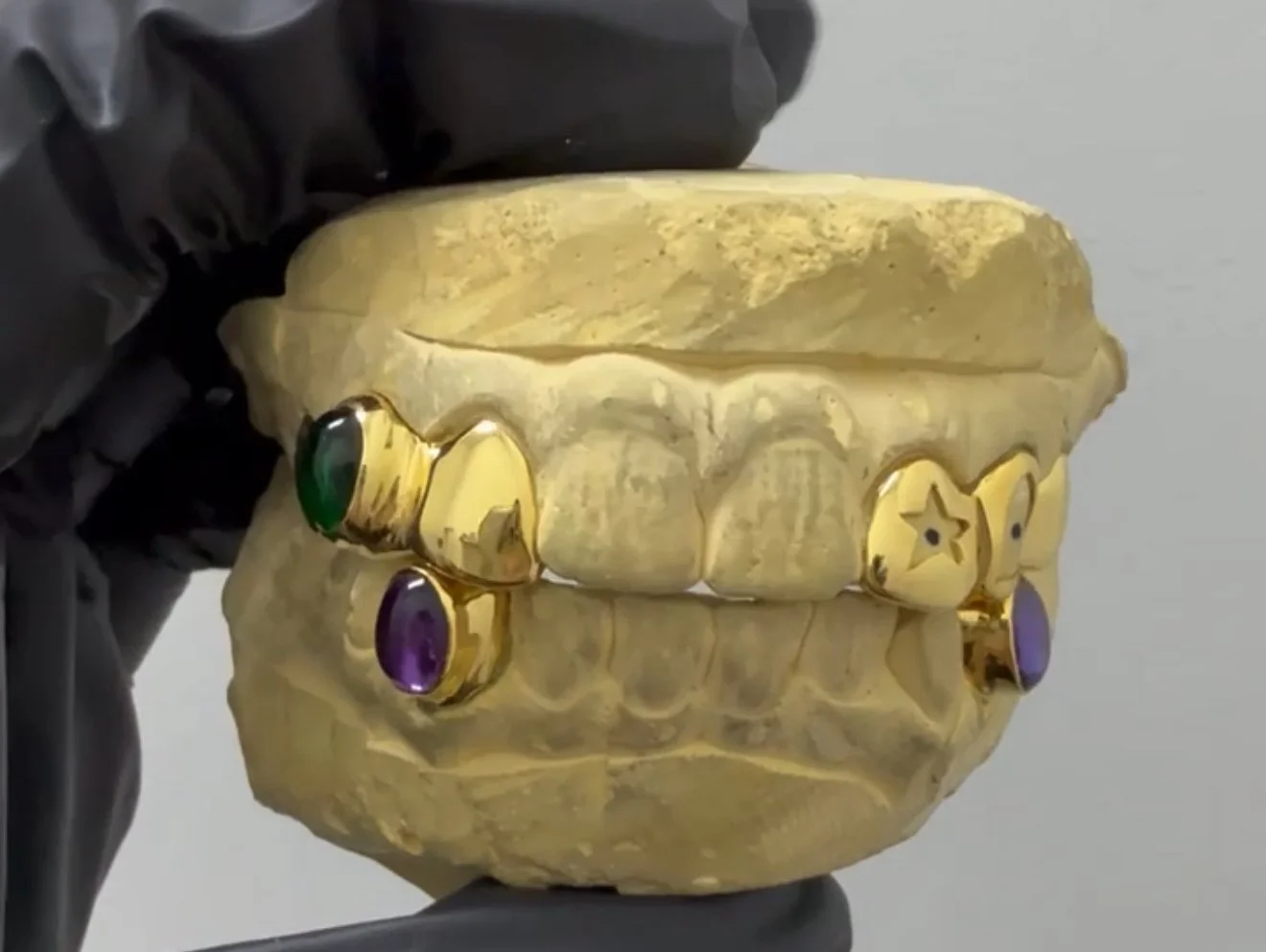 Gold 2pc x 2pc x cap grillz with stones on the south side of Chicago.