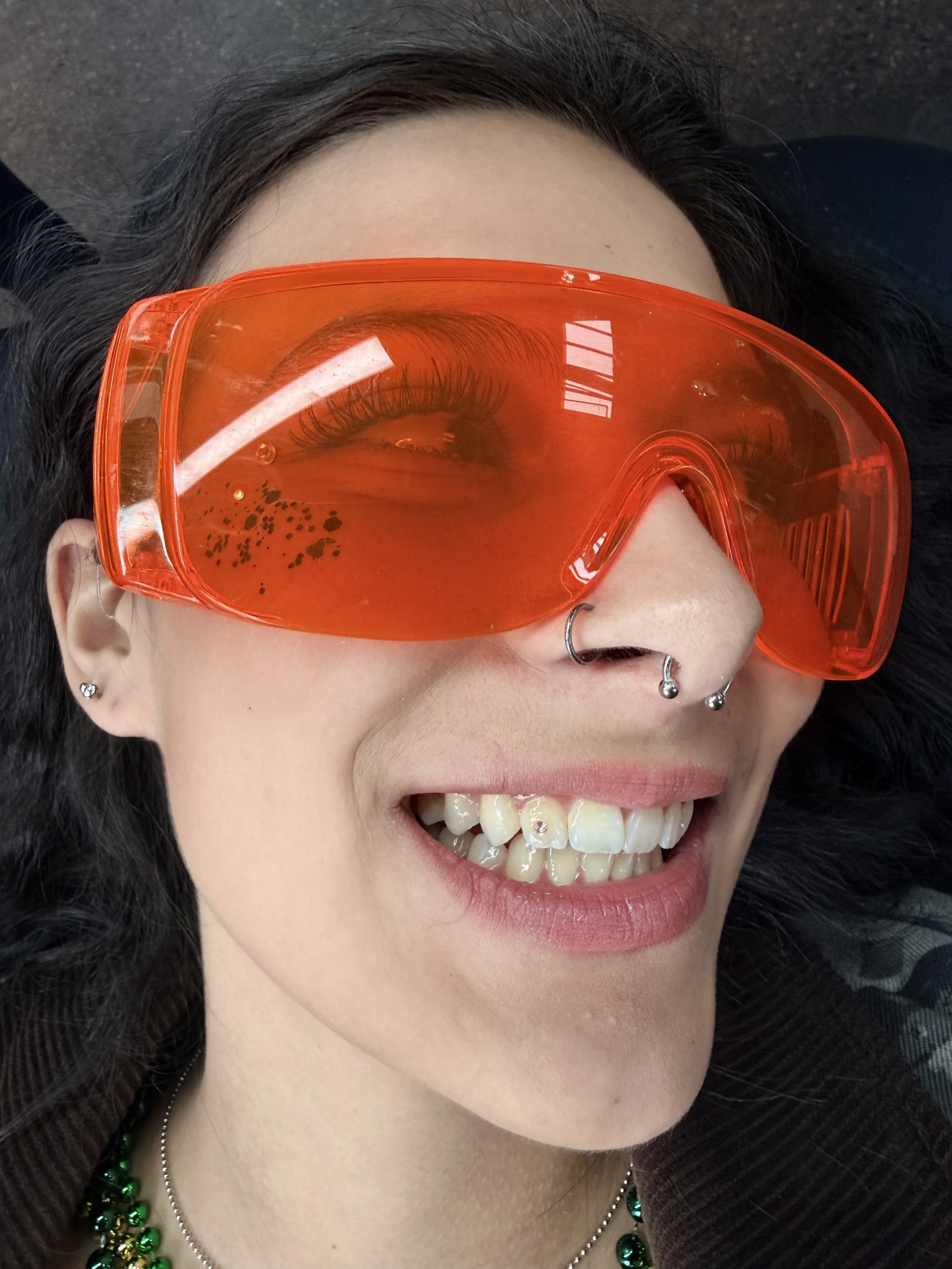 Single tooth gems chicago