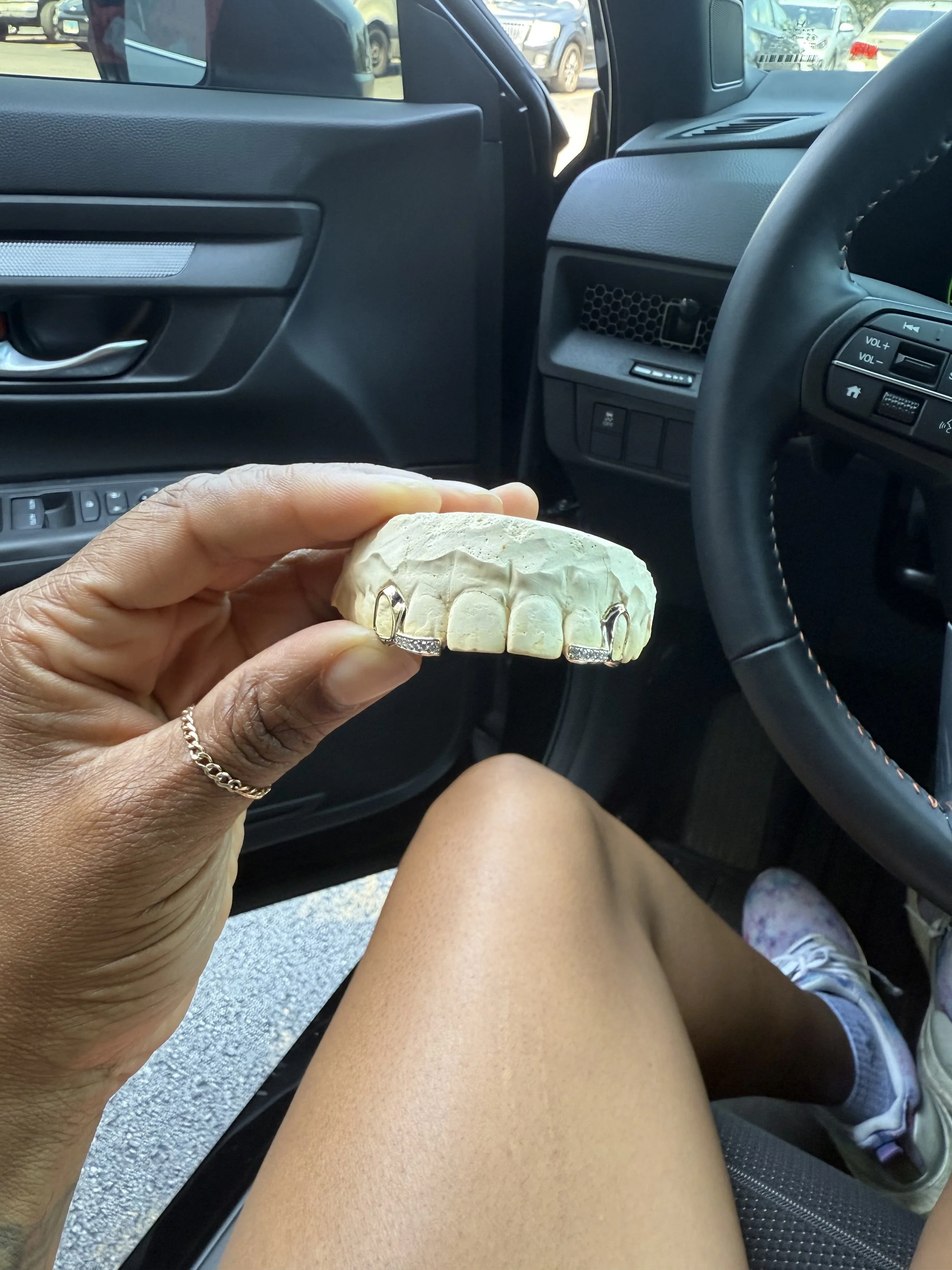 Person holding a dental impression model of teeth with gold dental crowns in a car interior on the south side of Chicago.