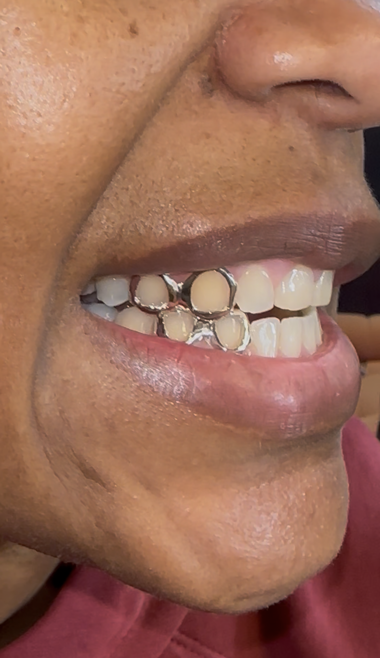 Silver grillz 2pc top and bottom in Chicago