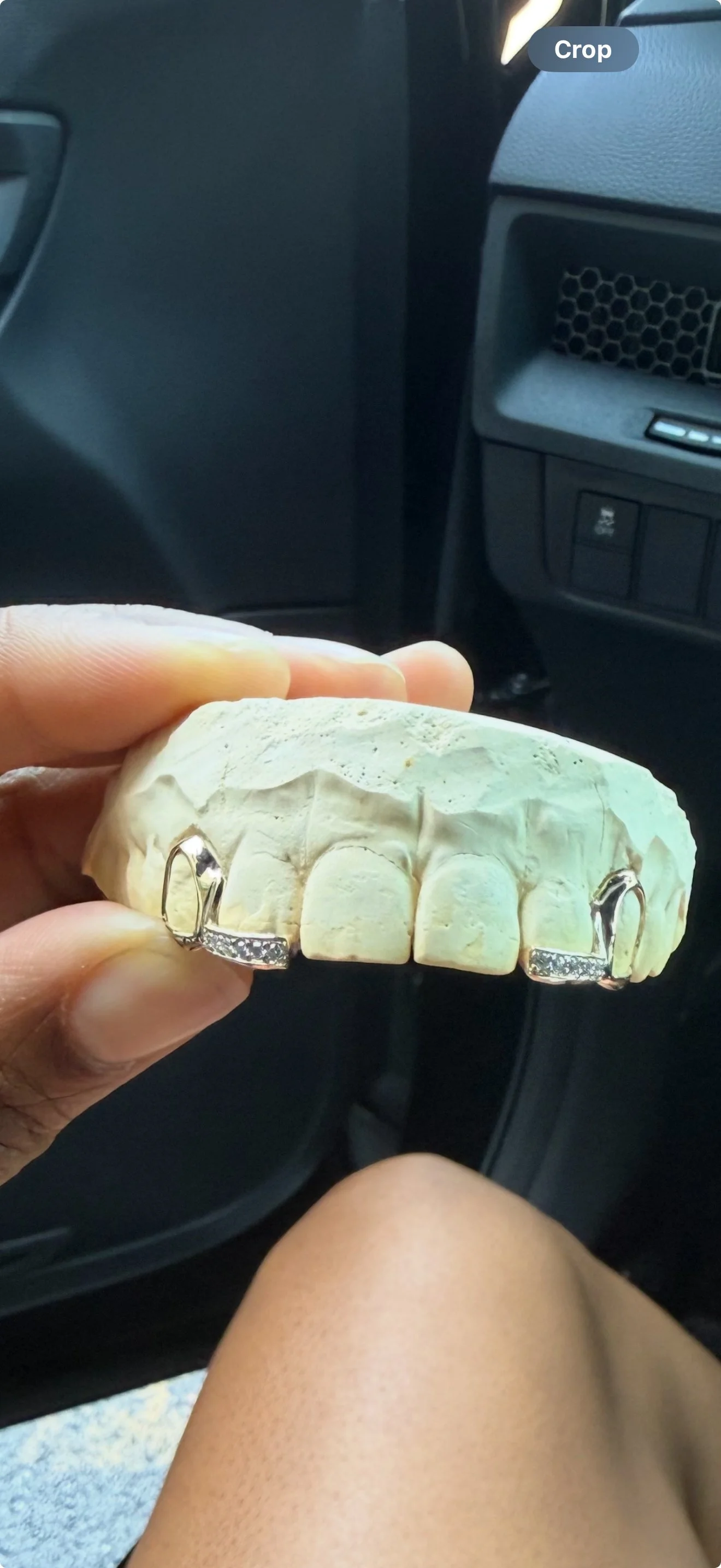 A person 2pc x 2pc grillz with diamond tips on the south side of Chicago.