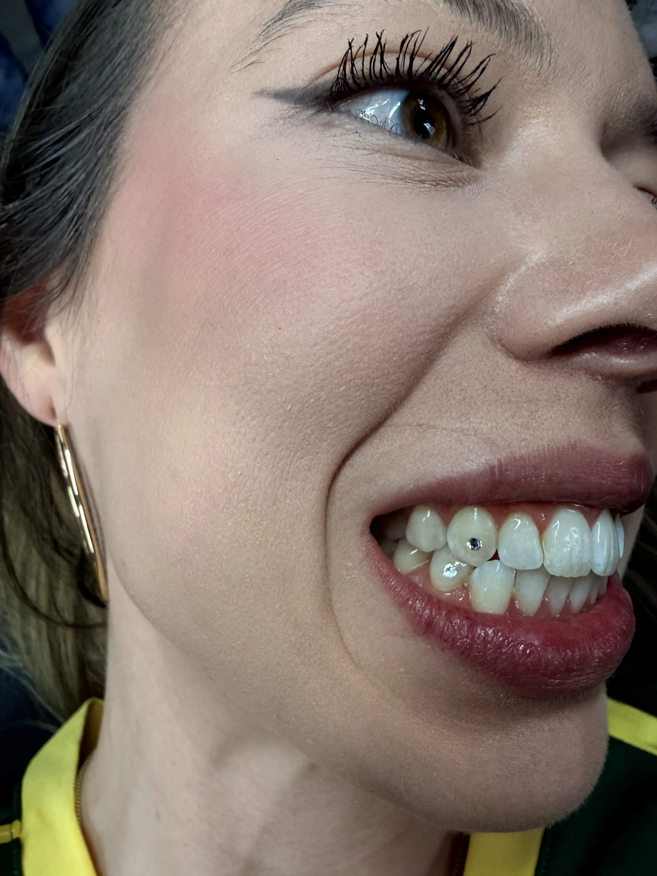 double single tooth gems in chicago