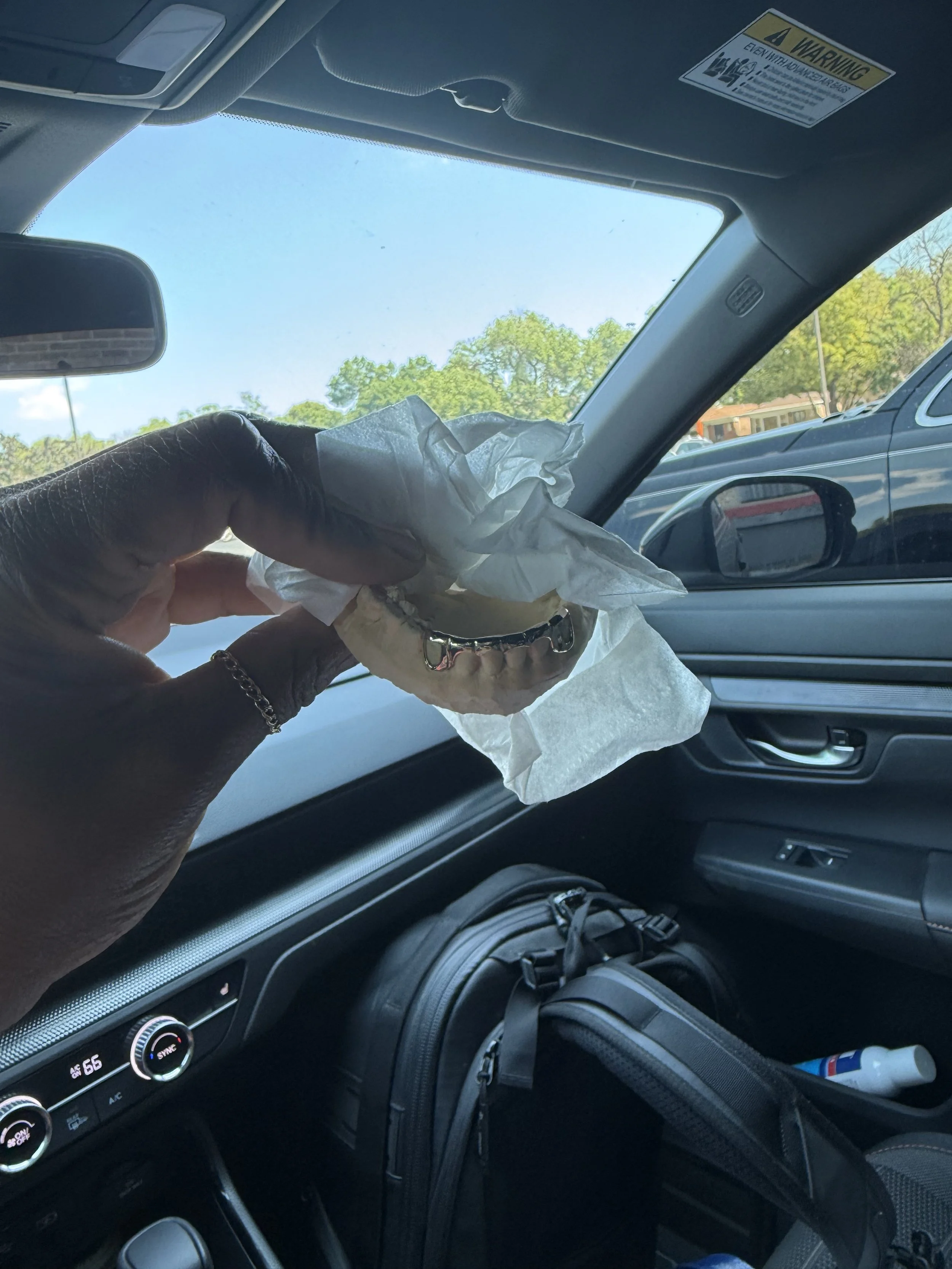 6pc 10k Gold Custom Grillz in Chicago 