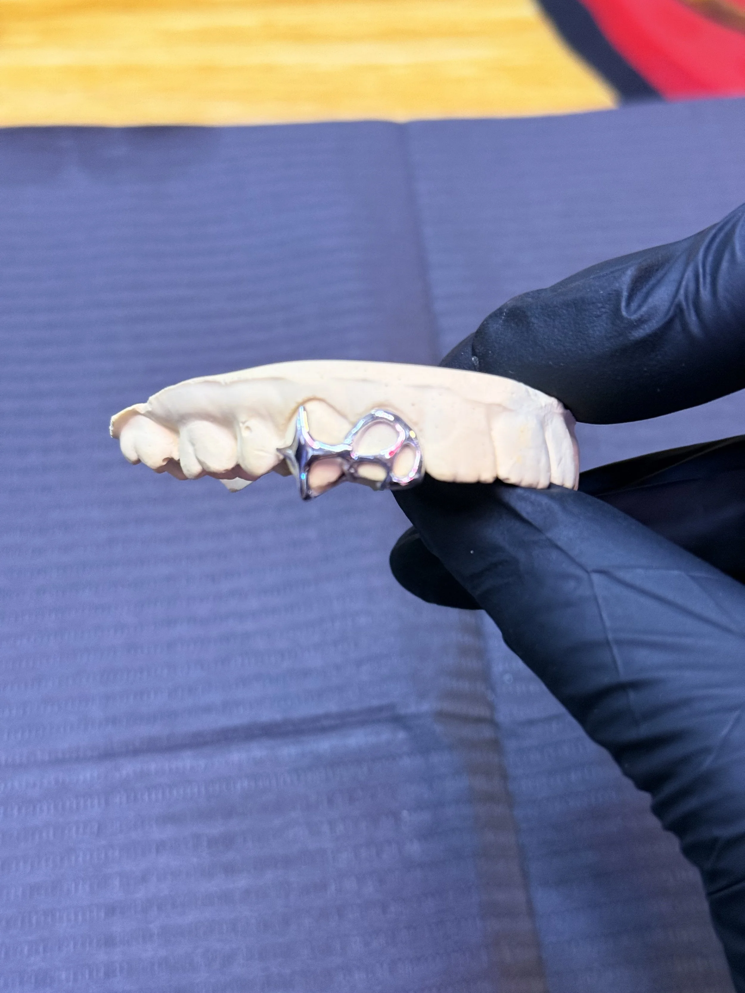 Single silver  custom grillz design