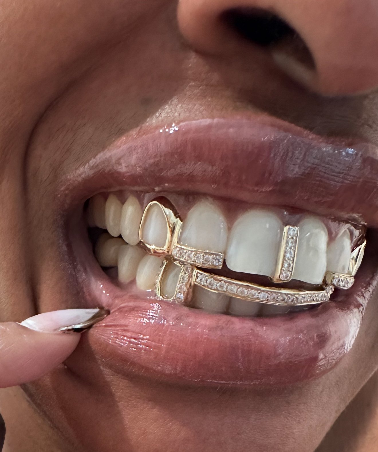Close-up of a person wearing gold grillz with diamond embellishments on their teeth, with their mouth slightly open showing some teeth and lips, and a finger with a painted nail touching the lower lip on the south side of Chicago.