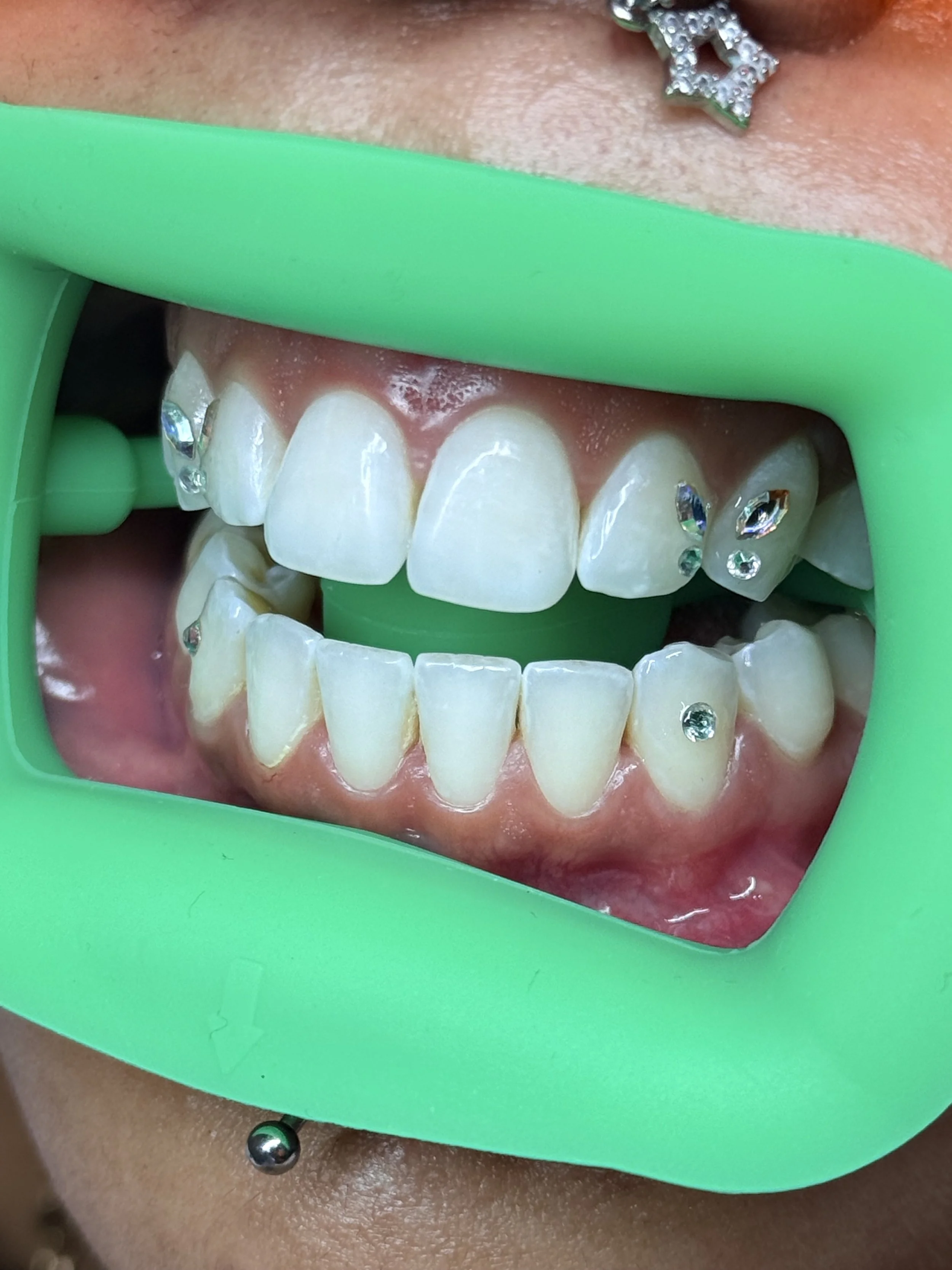 Close up of double butterfly tooth gems in Chicago