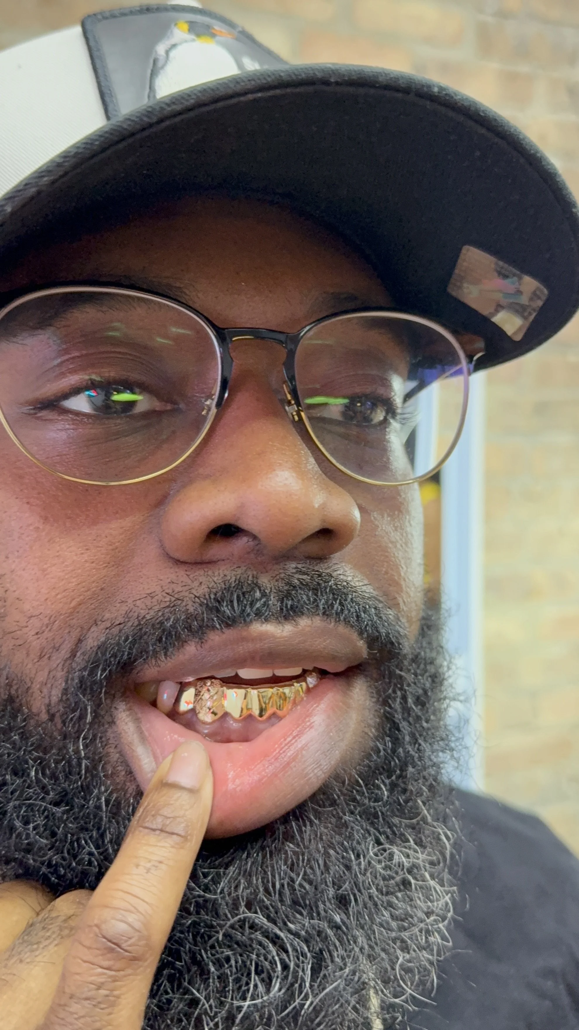 8 pc botton gold grillz chicago