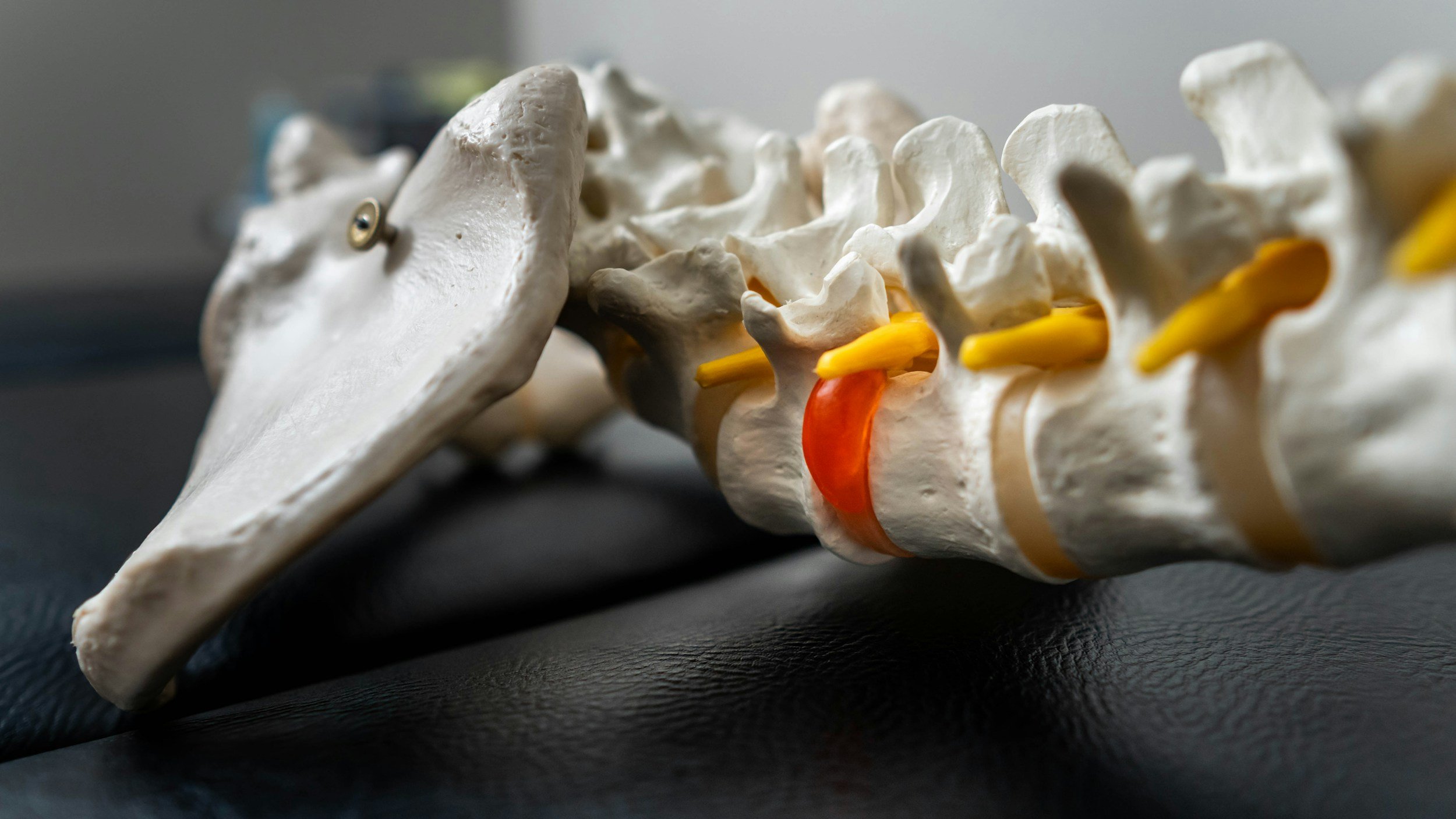 Sciatica: What It Really Is (And Why Spinal Decompression Could Be the Answer)