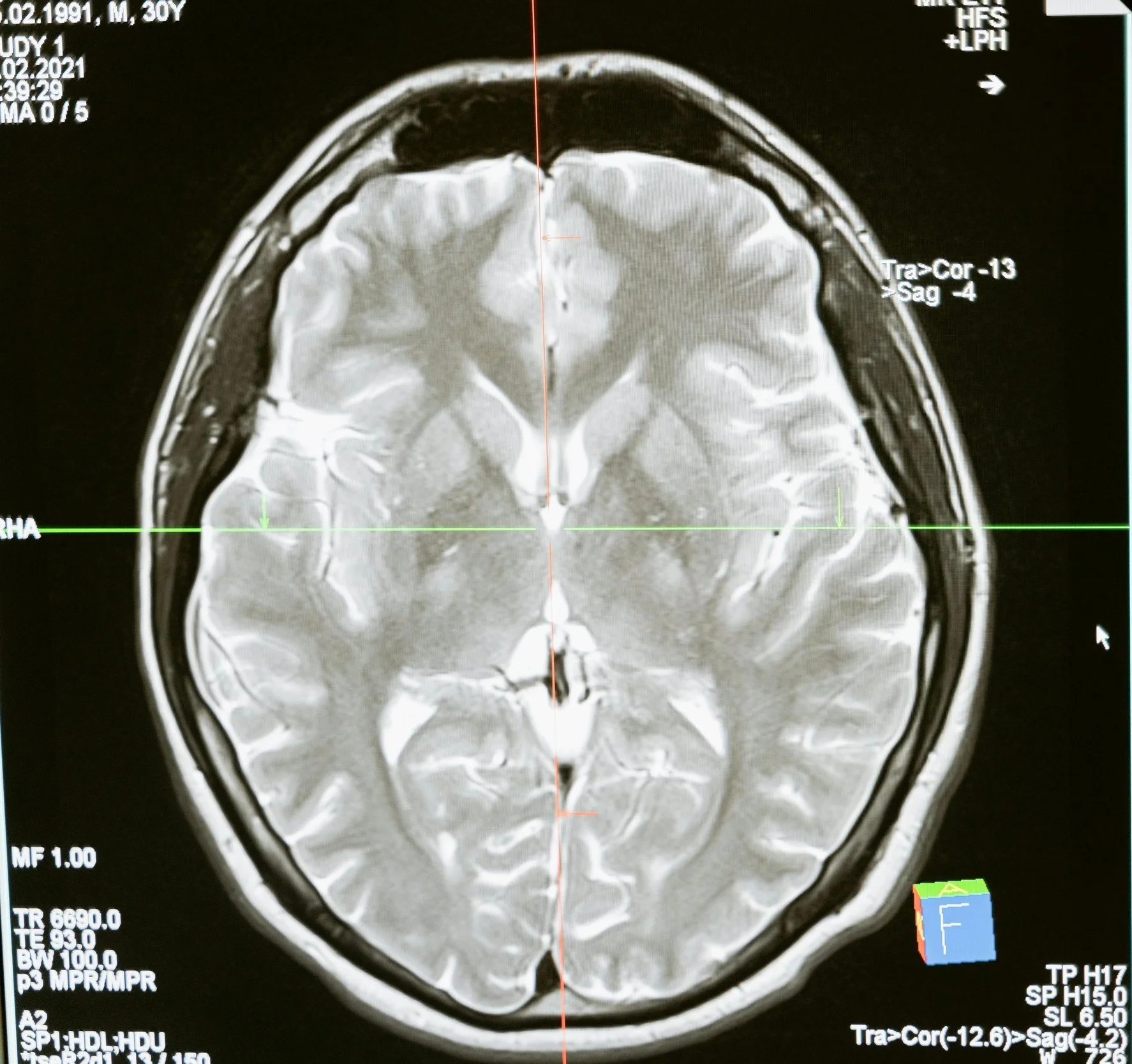 The Science Behind EFT: What Does the Research Say?