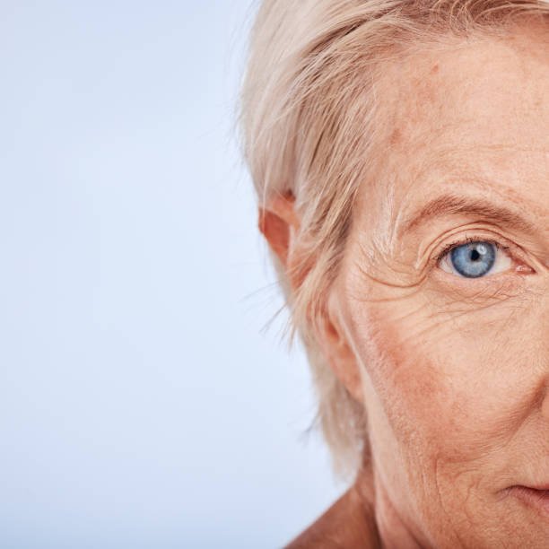 Close-up of the right side of an elderly woman's face with blue eyes and light-colored hair.