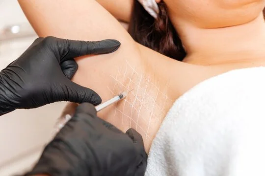 A medical professional in black gloves administering a skin treatment or injection on a woman's underarm area, with a white towel or cloth covering her shoulder.