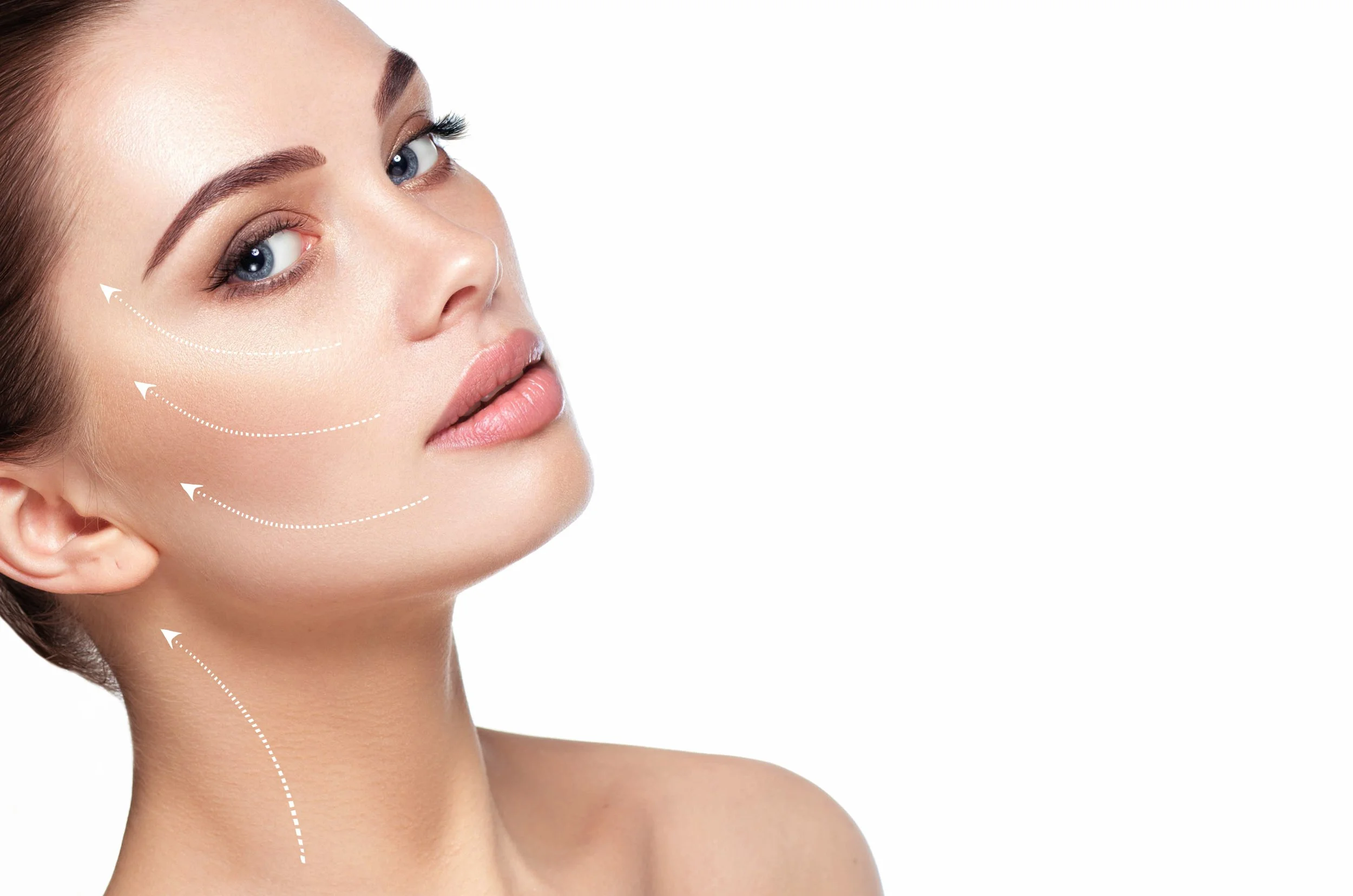 Close-up of a woman's face showing contour lines for cosmetic or aesthetic treatment, with a focus on her forehead, cheek, and jawline.