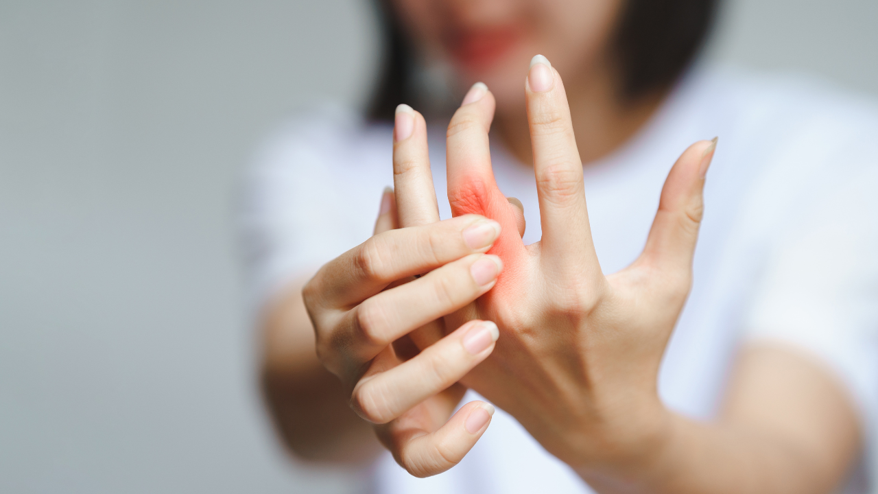 Rheumatoid Arthritis Flares: How to Avoid the 7 Most Common Mistakes and Protect Your Joints