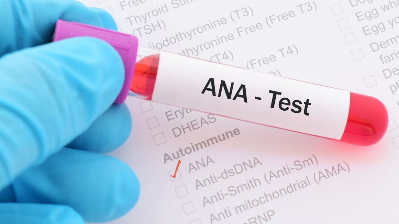 The REAL Meaning Behind Your ANA Positive Blood Test