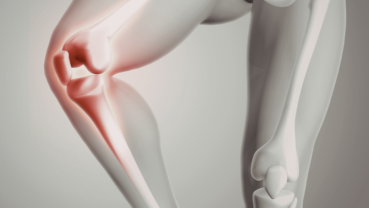 Why Steroids Weaken Bones and How to Prevent It