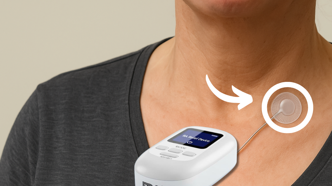 FDA Approves Vagus Nerve Stimulator for Rheumatoid Arthritis Relief