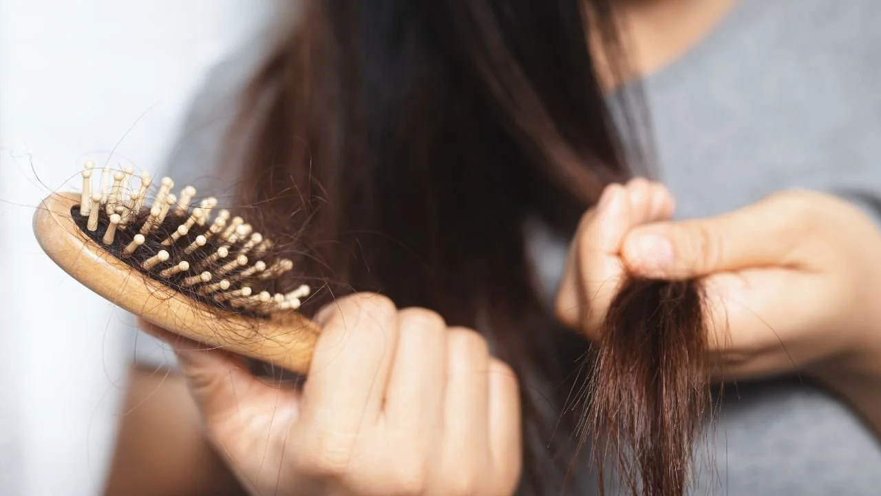 Methotrexate Hair Loss in Rheumatoid Arthritis