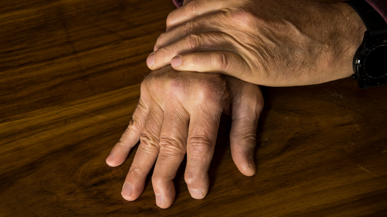 5 Critical Differences Between Rheumatoid Arthritis and Psoriatic Arthritis