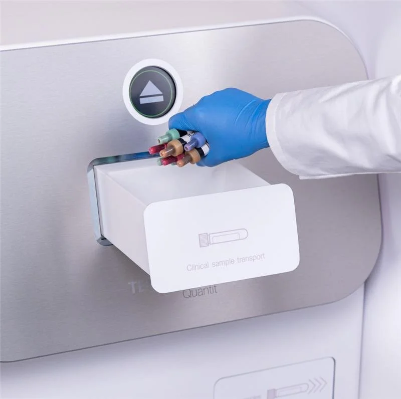 Why TAT for Blood Samples Is Important in Hospital Operations